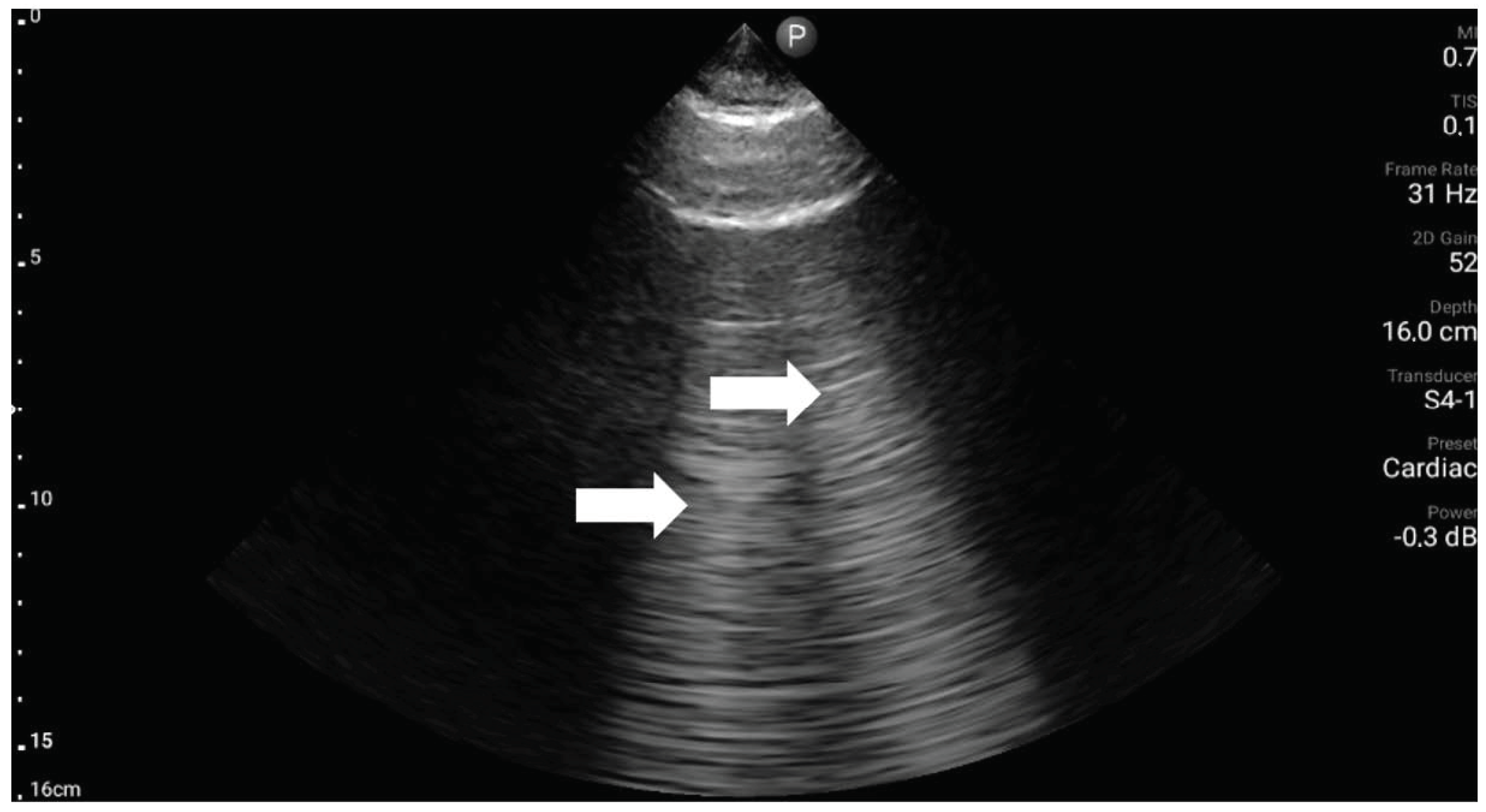 Medicina 59 00224 g005