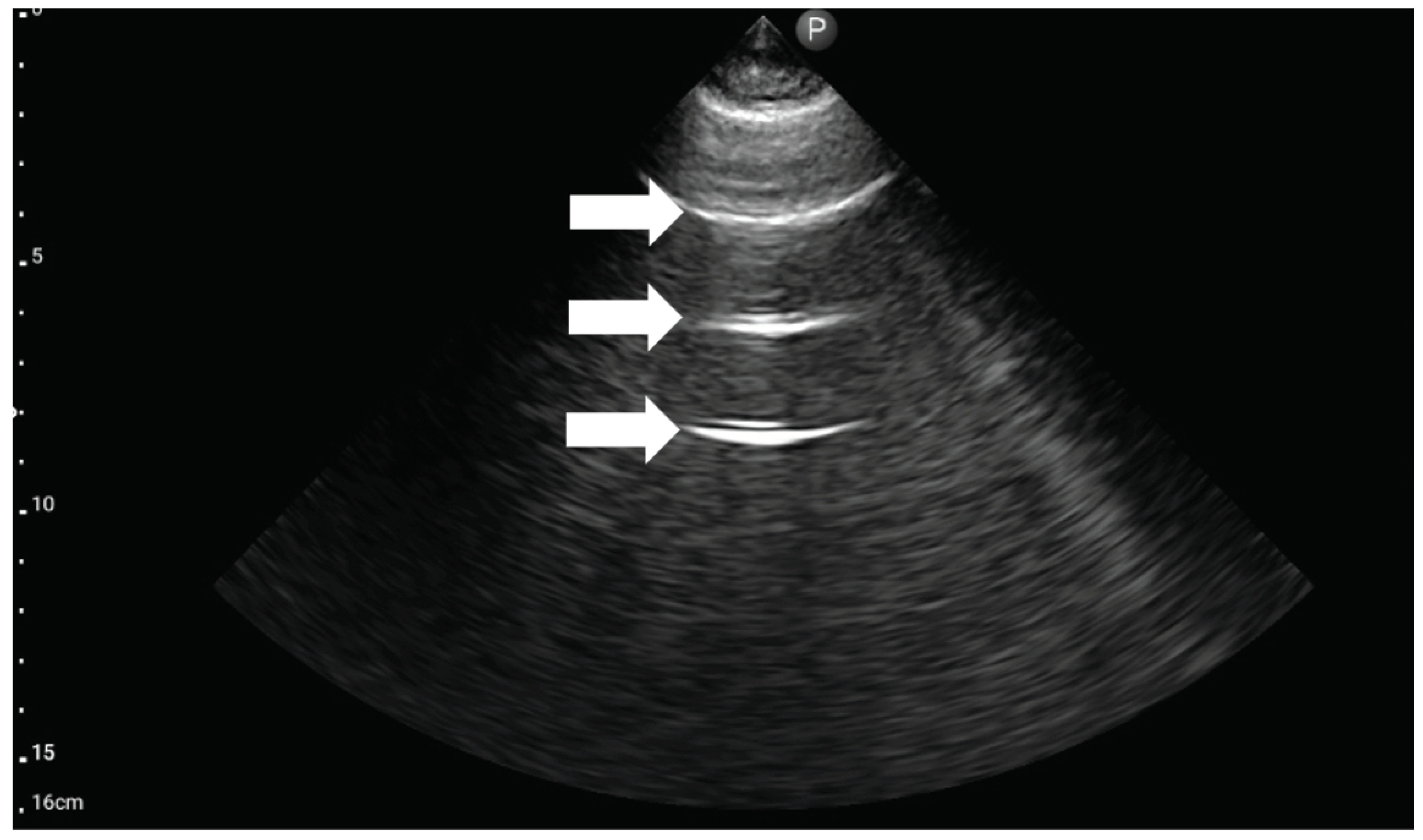 Medicina 59 00224 g006