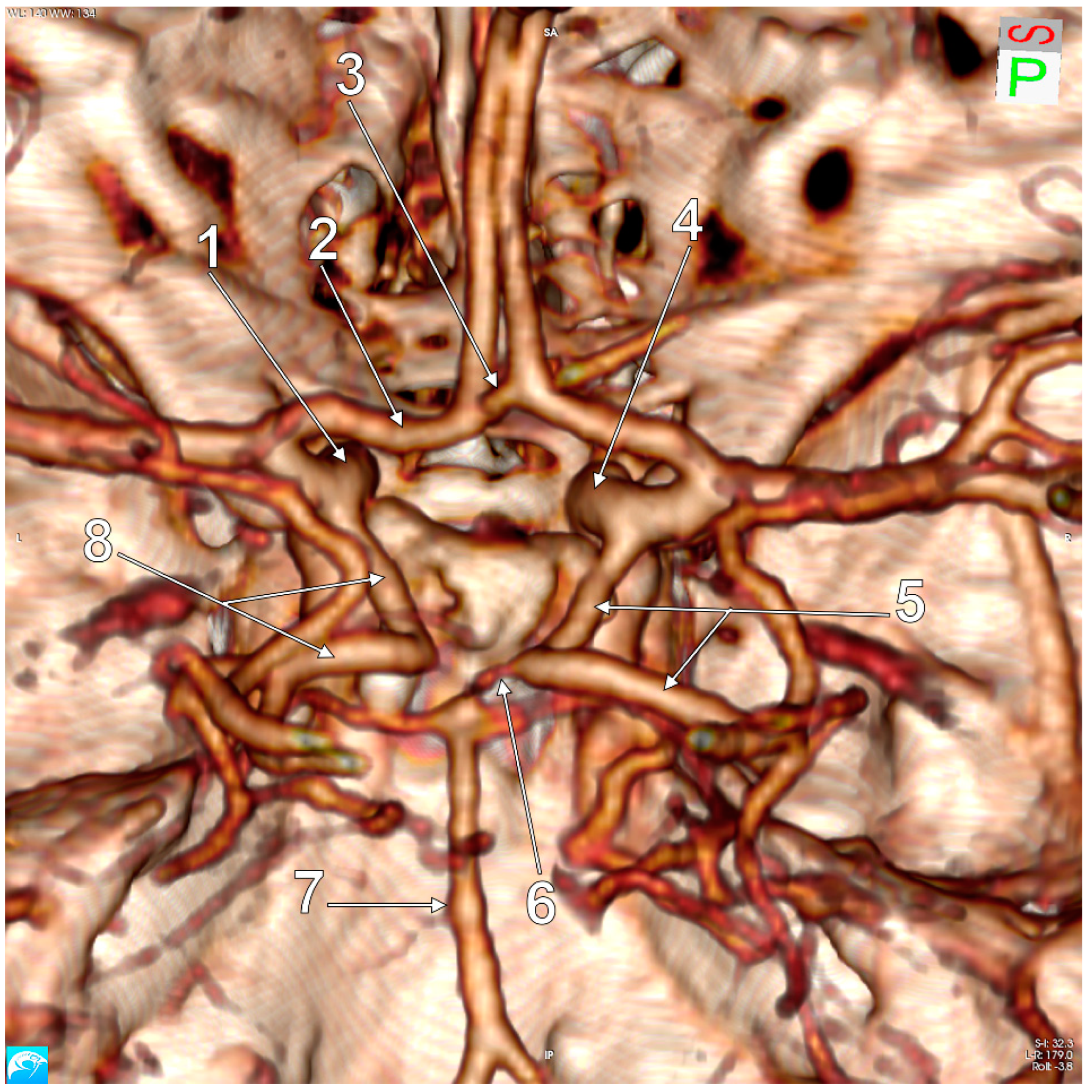 Medicina 59 00231 g004 Medicina 59 00231 g004