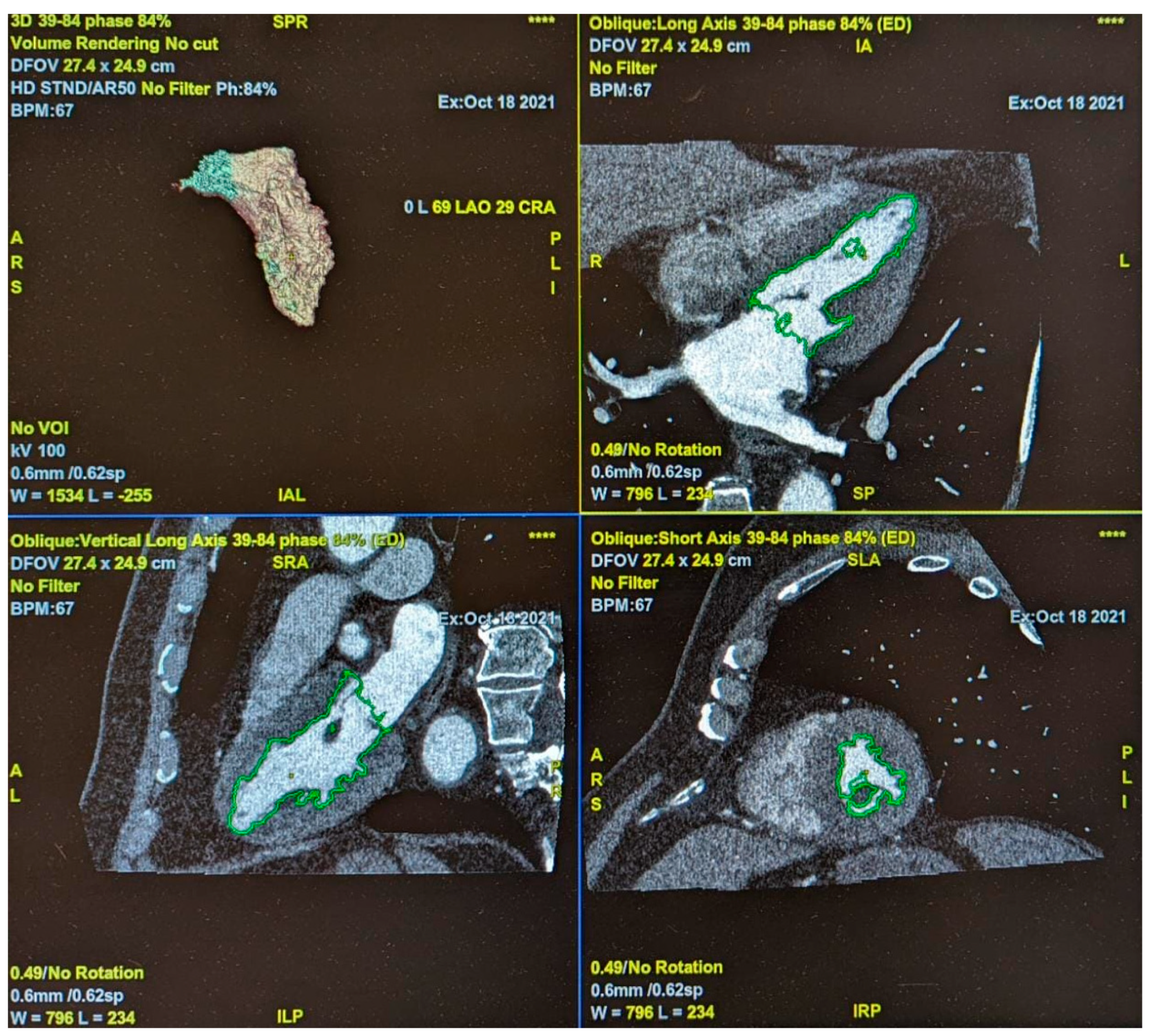 Medicina 59 00232 g002 Medicina 59 00232 g002
