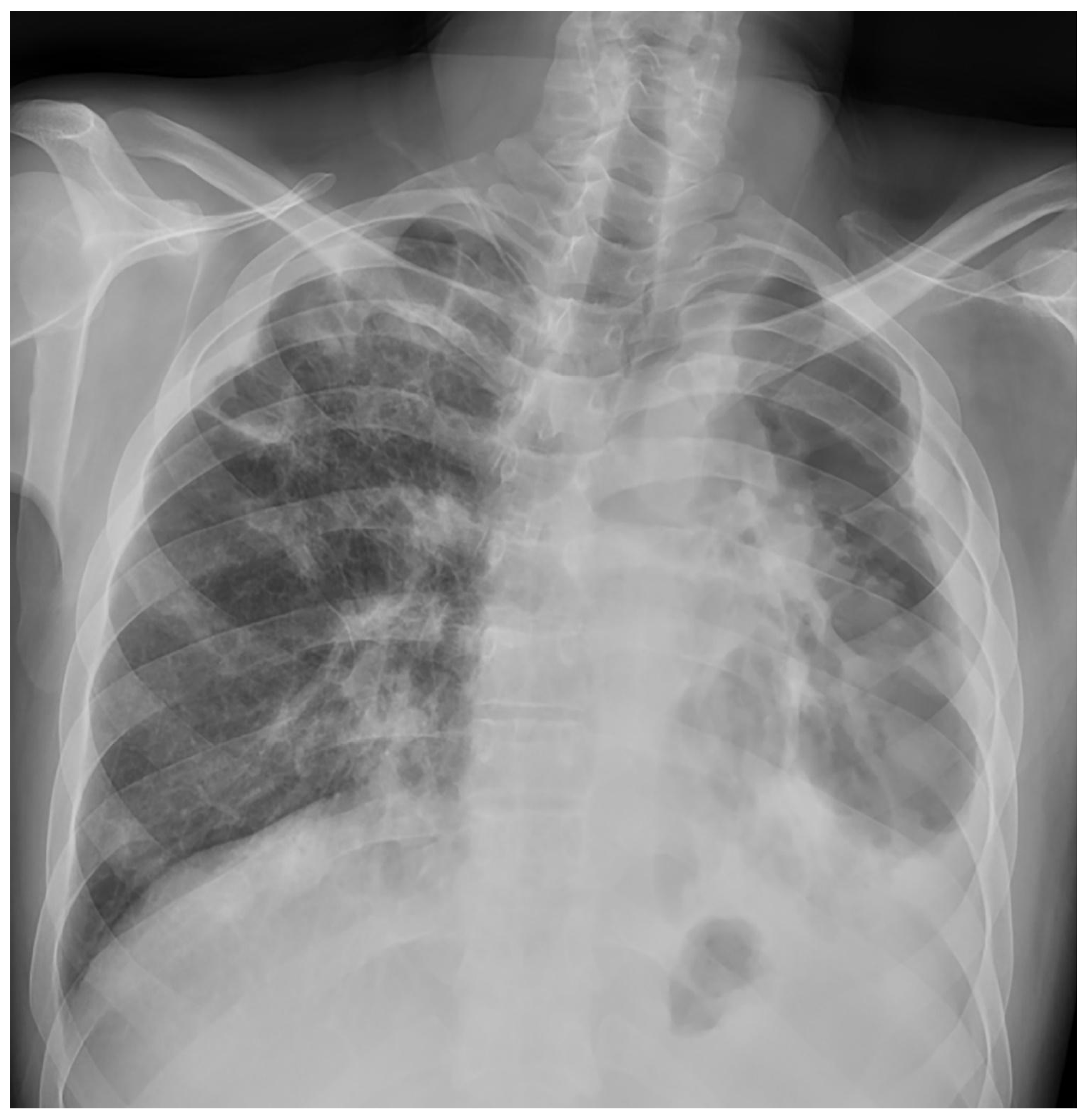 Medicina 59 00246 g002