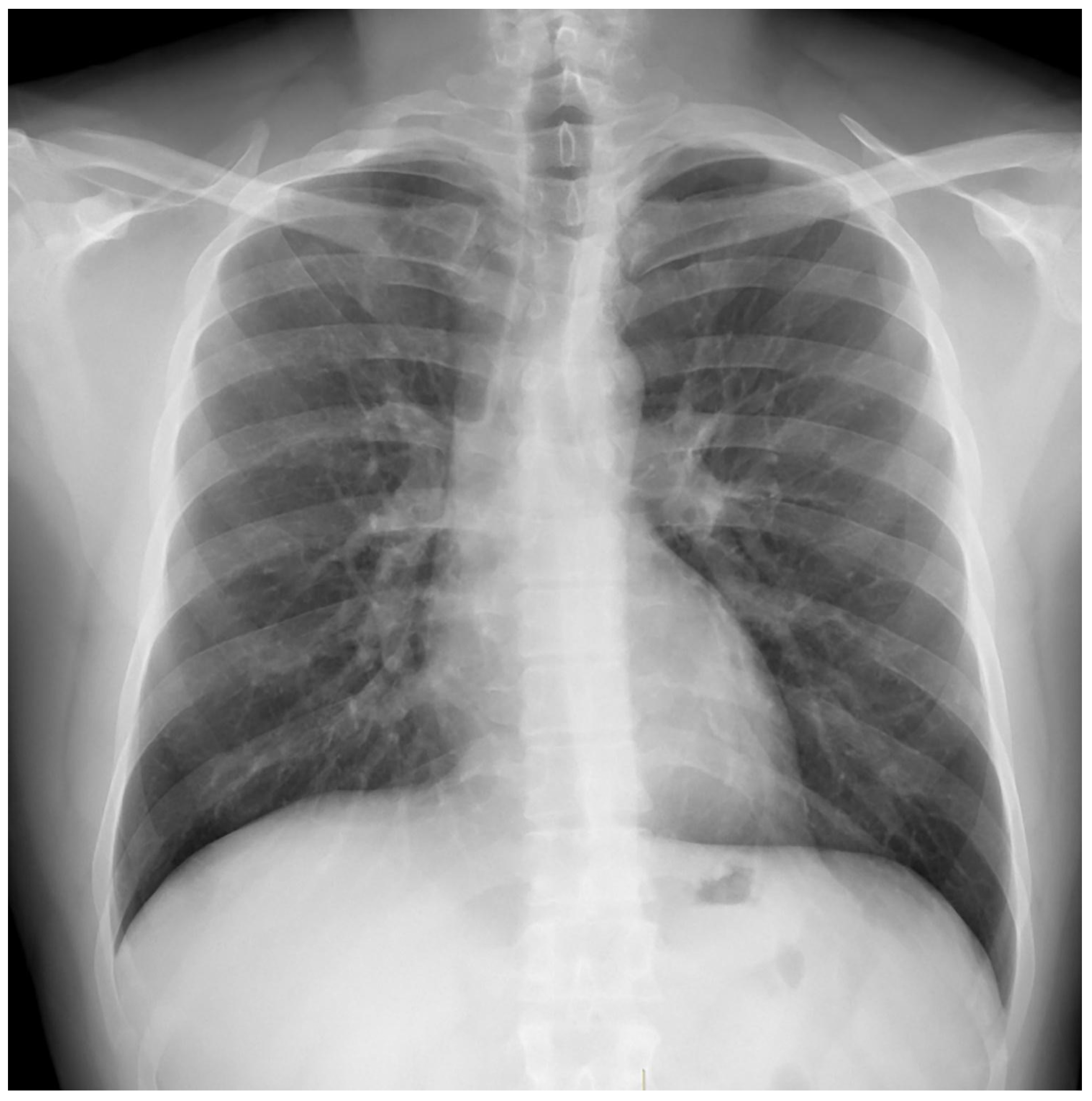 Medicina 59 00246 g004