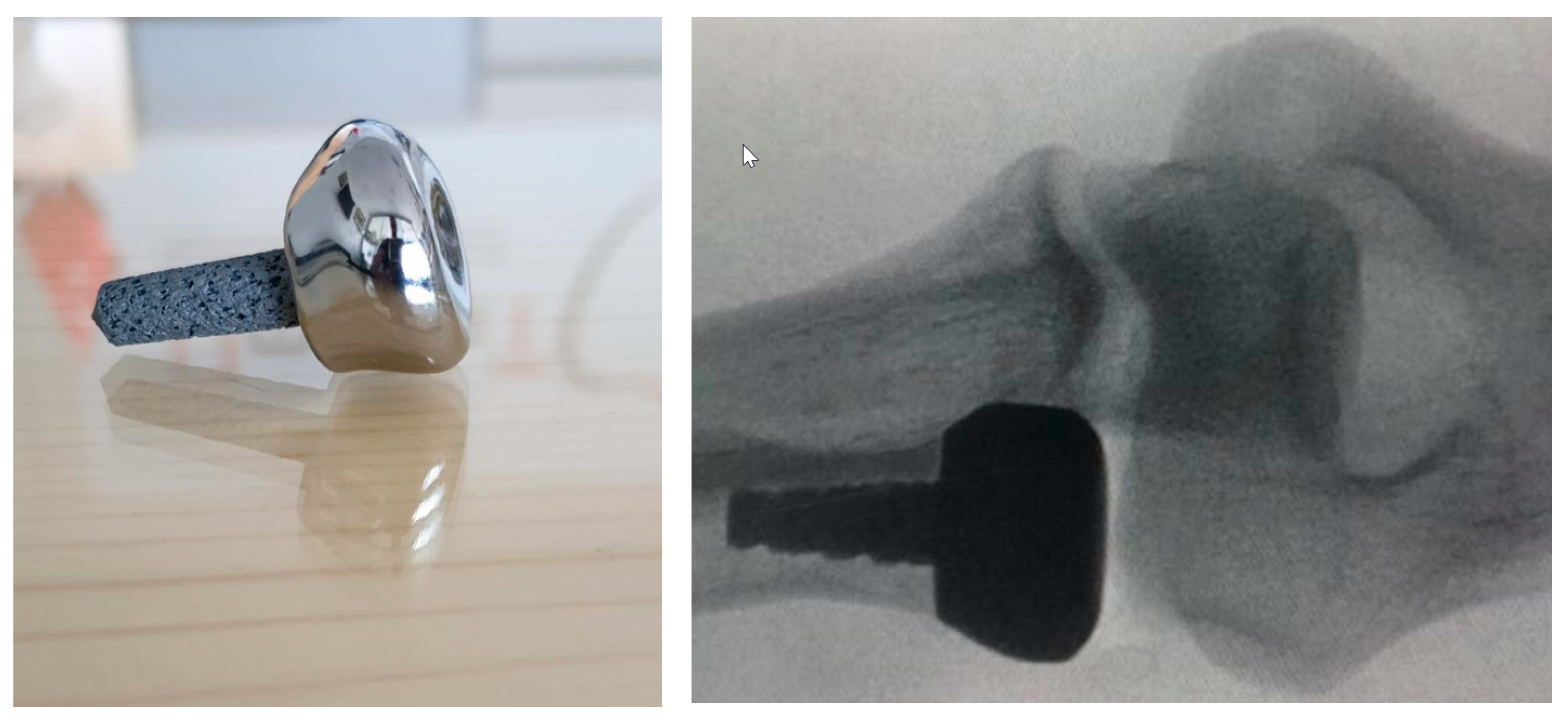 Medicina 59 00249 g002 Medicina 59 00249 g002