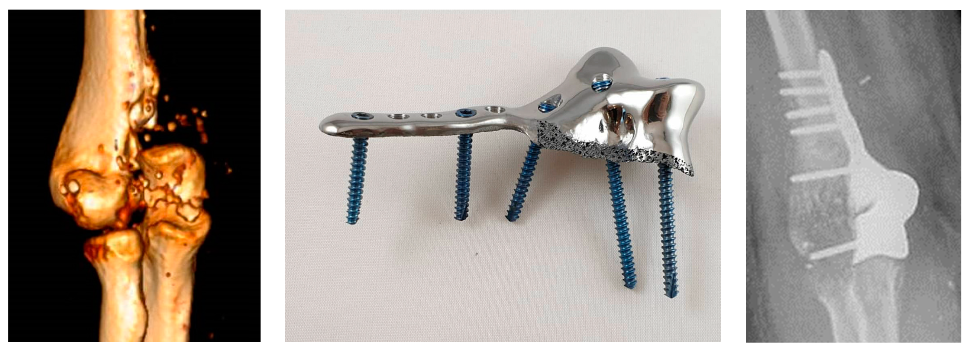 Medicina 59 00249 g003 Medicina 59 00249 g003