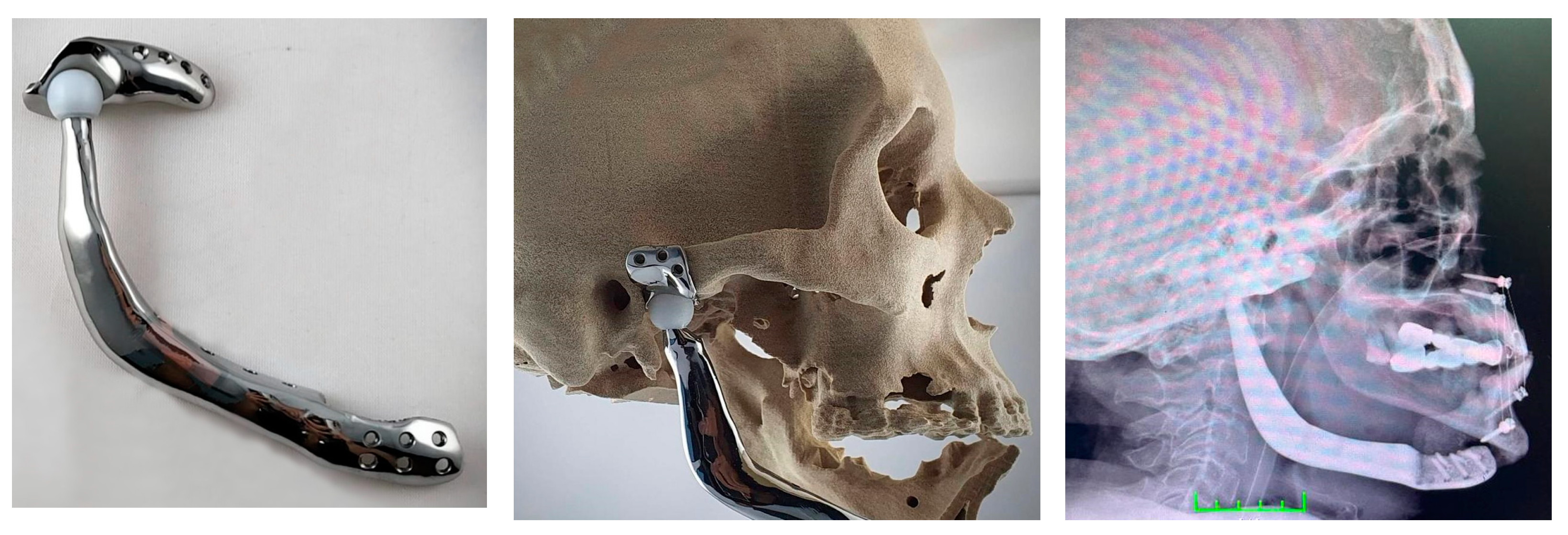 Medicina 59 00249 g004 Medicina 59 00249 g004