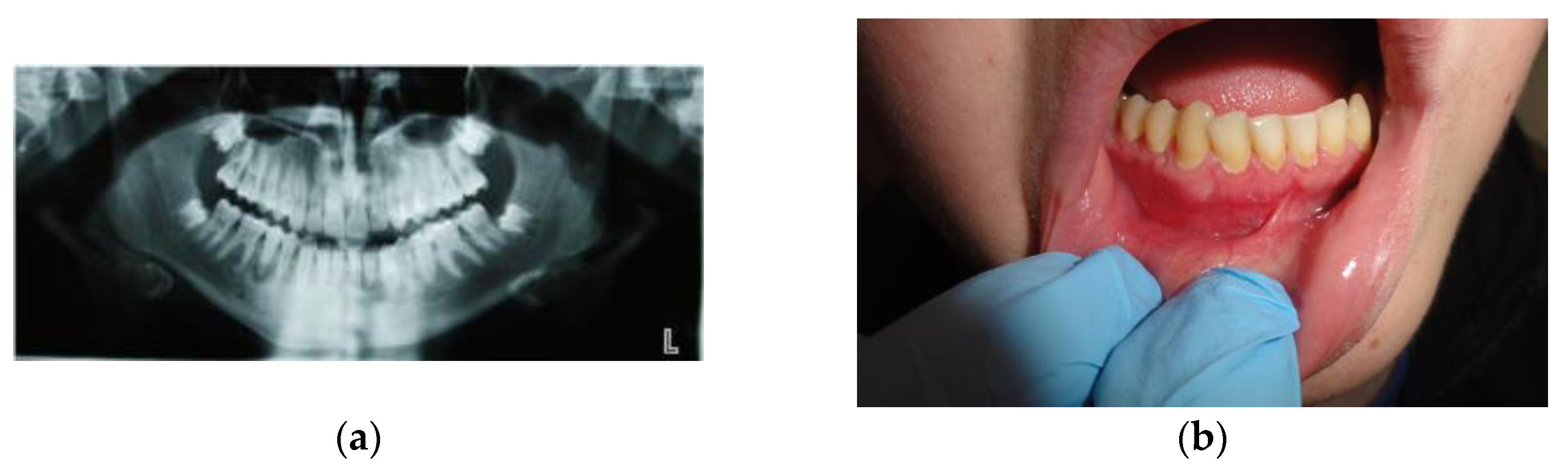 Medicina 59 00250 g004 550