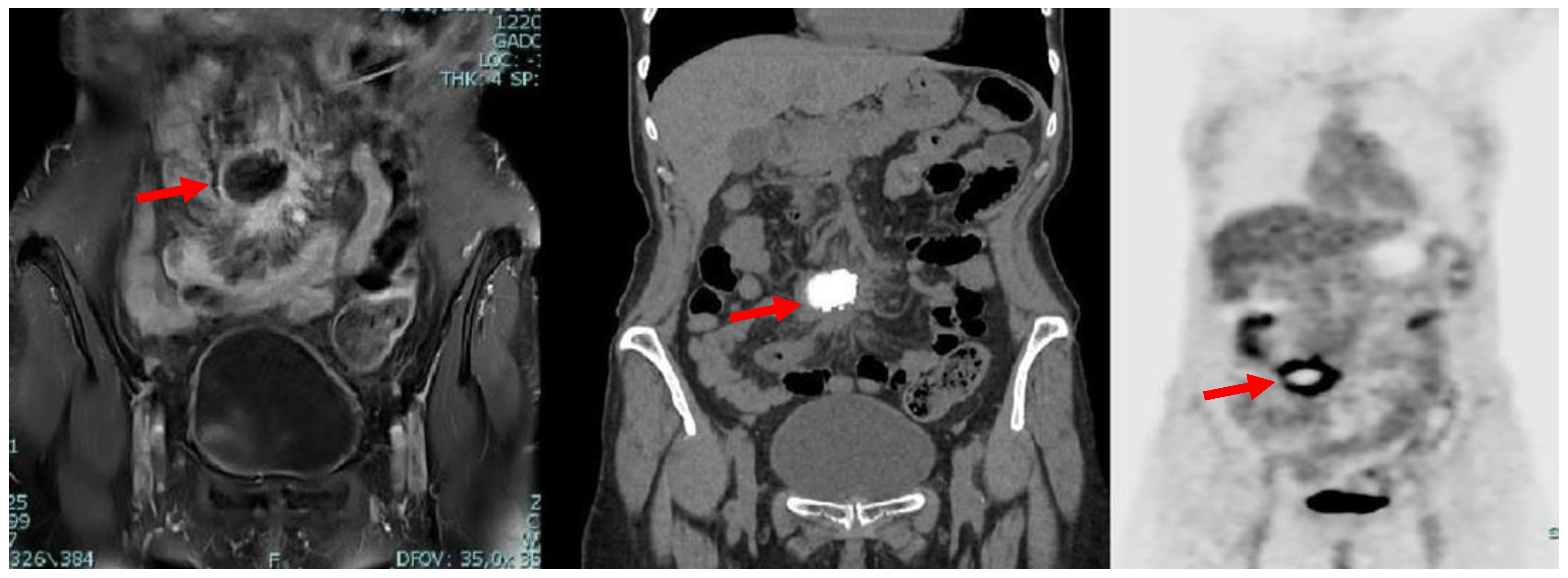 Medicina 59 00293 g002 Medicina 59 00293 g002