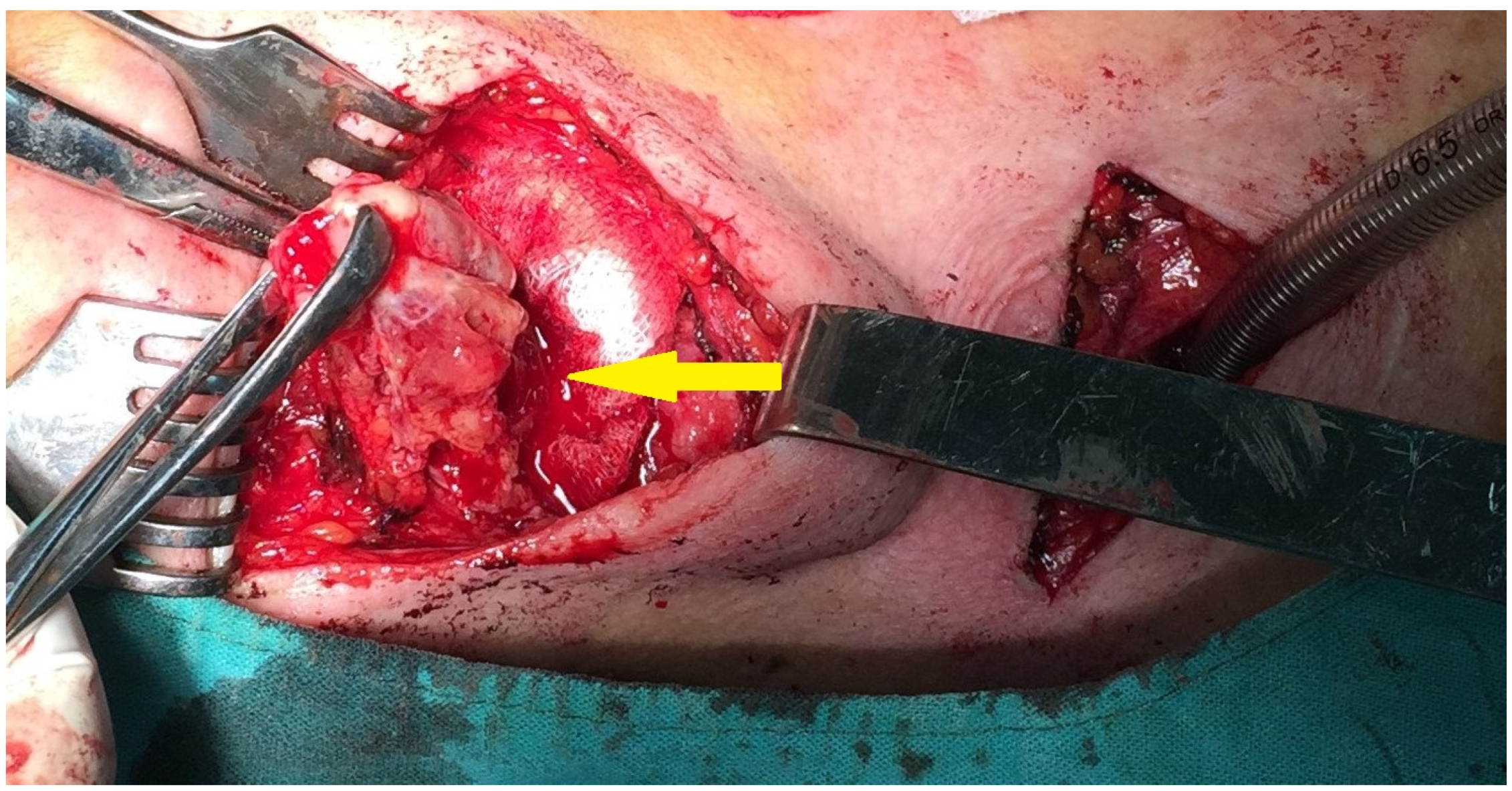 Medicina 59 00313 g003