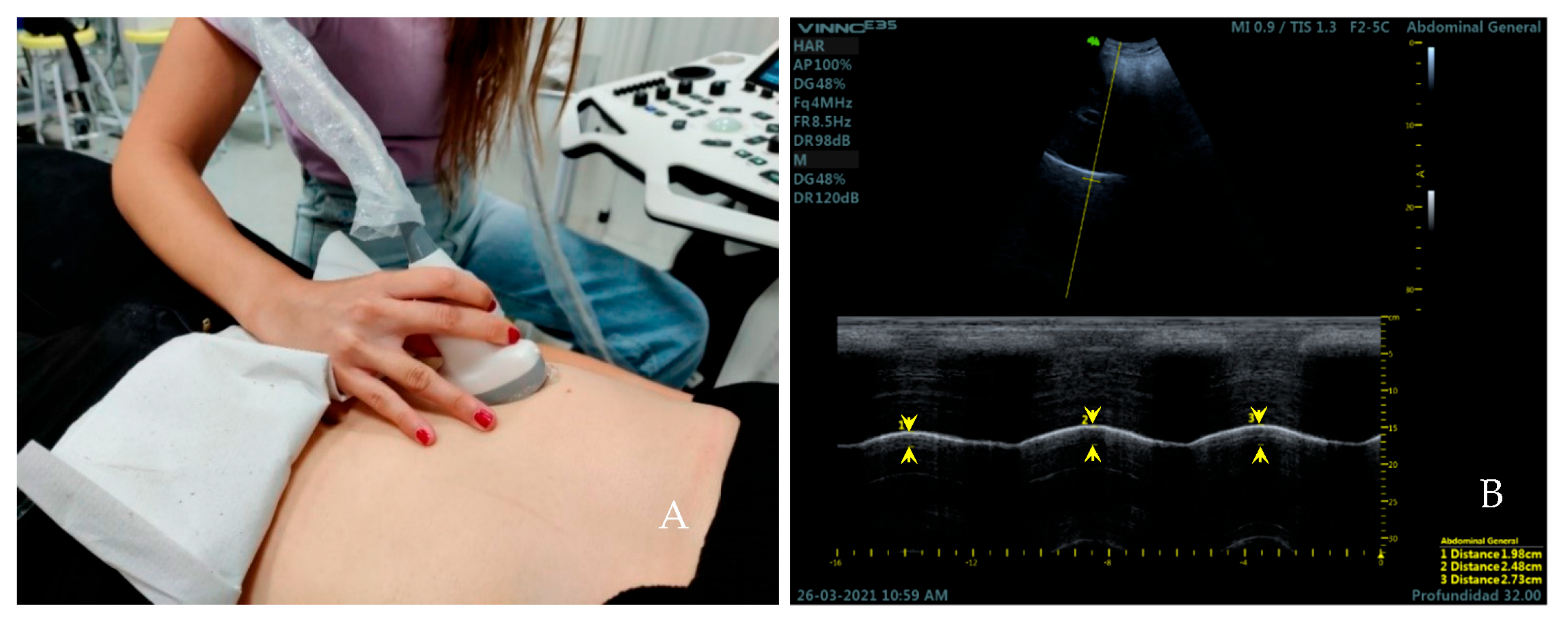 Medicina 59 00315 g002 Medicina 59 00315 g002