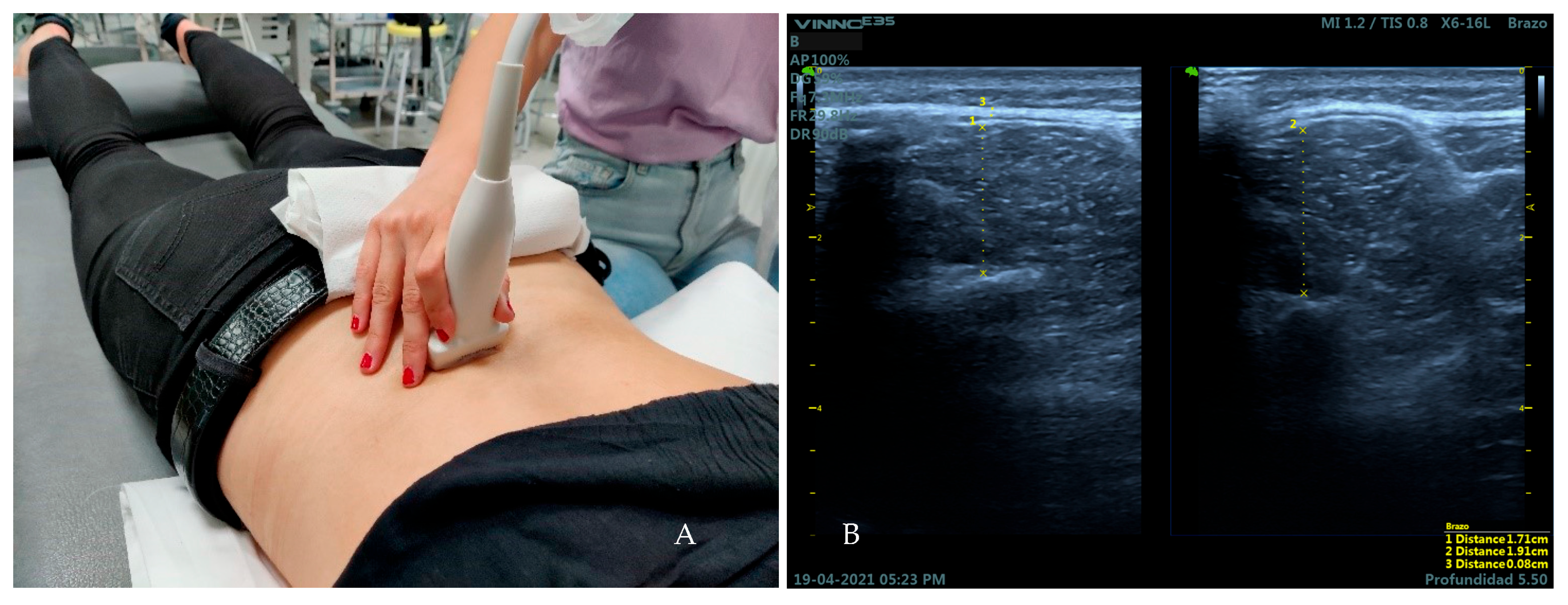Medicina 59 00315 g003 Medicina 59 00315 g003