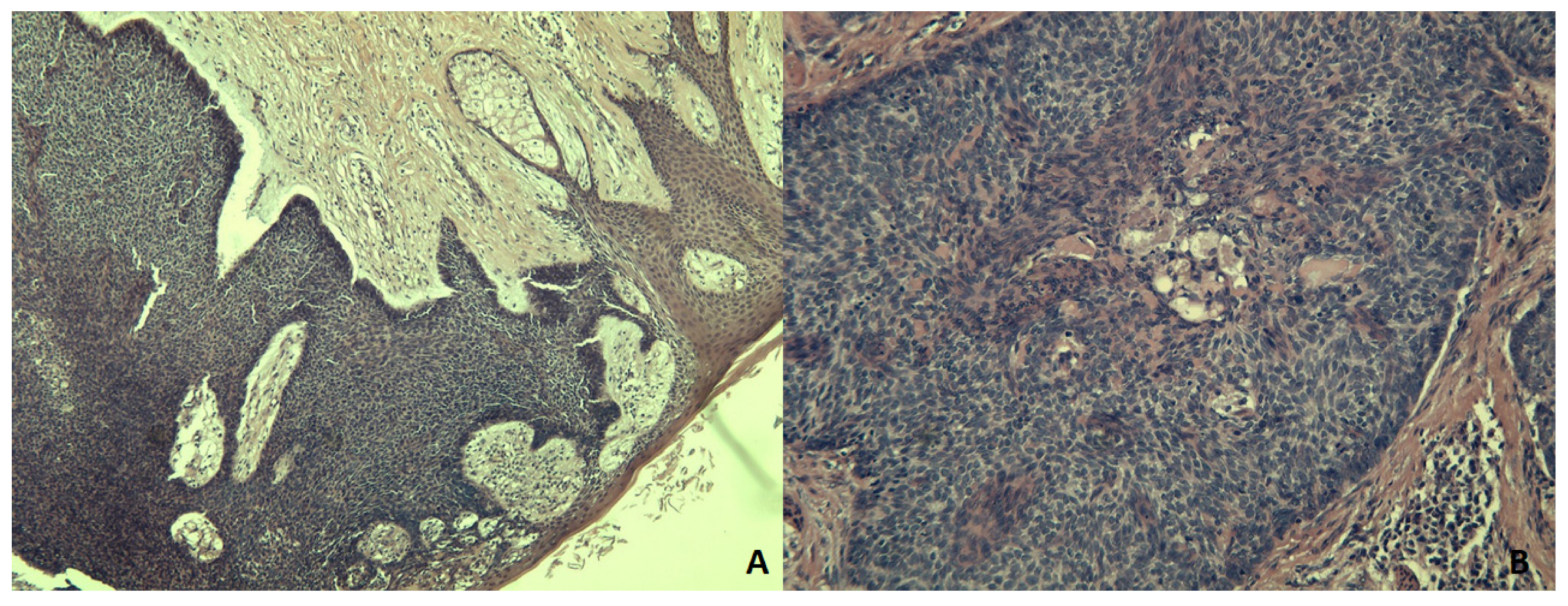 Medicina 59 00316 g002 Medicina 59 00316 g002