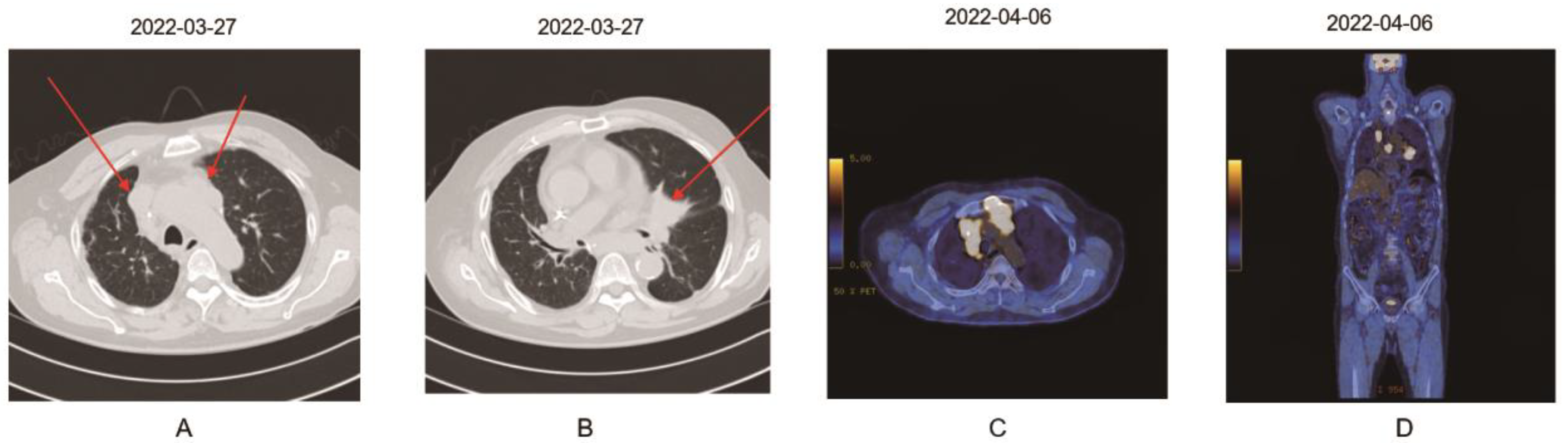 Medicina 59 00325 g002