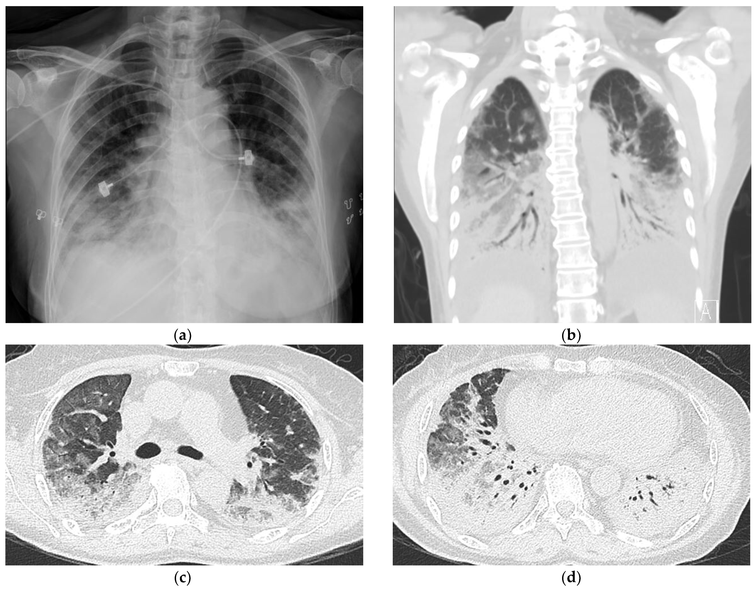Medicina 59 00330 g002 Medicina 59 00330 g002