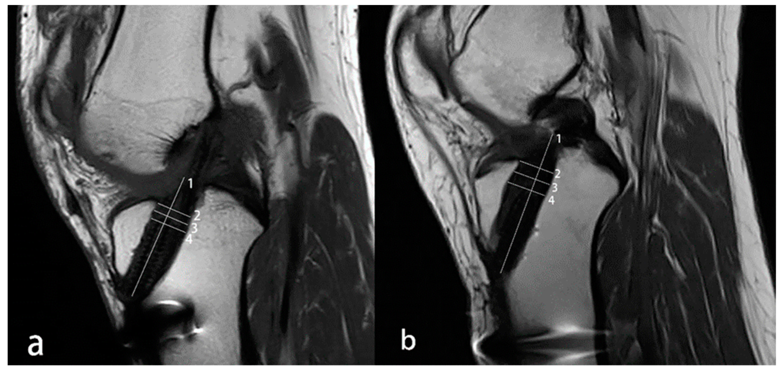 Medicina 59 00390 g004 Medicina 59 00390 g004