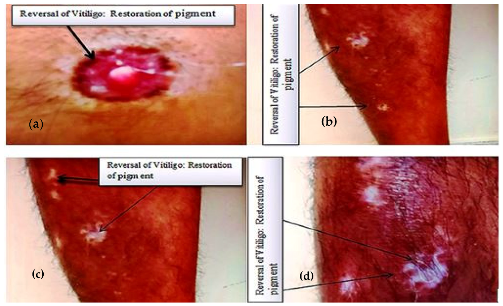 Medicina 59 00427 g002