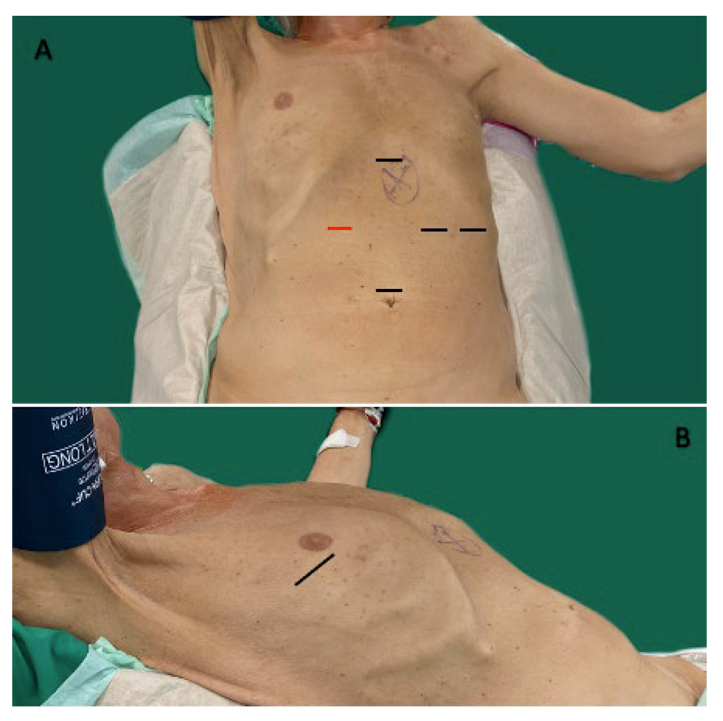 Medicina 59 00434 g002 Medicina 59 00434 g002
