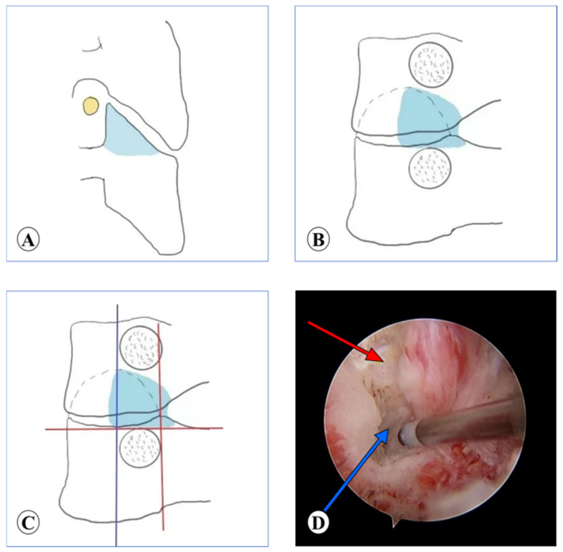 Medicina 59 00437 g004