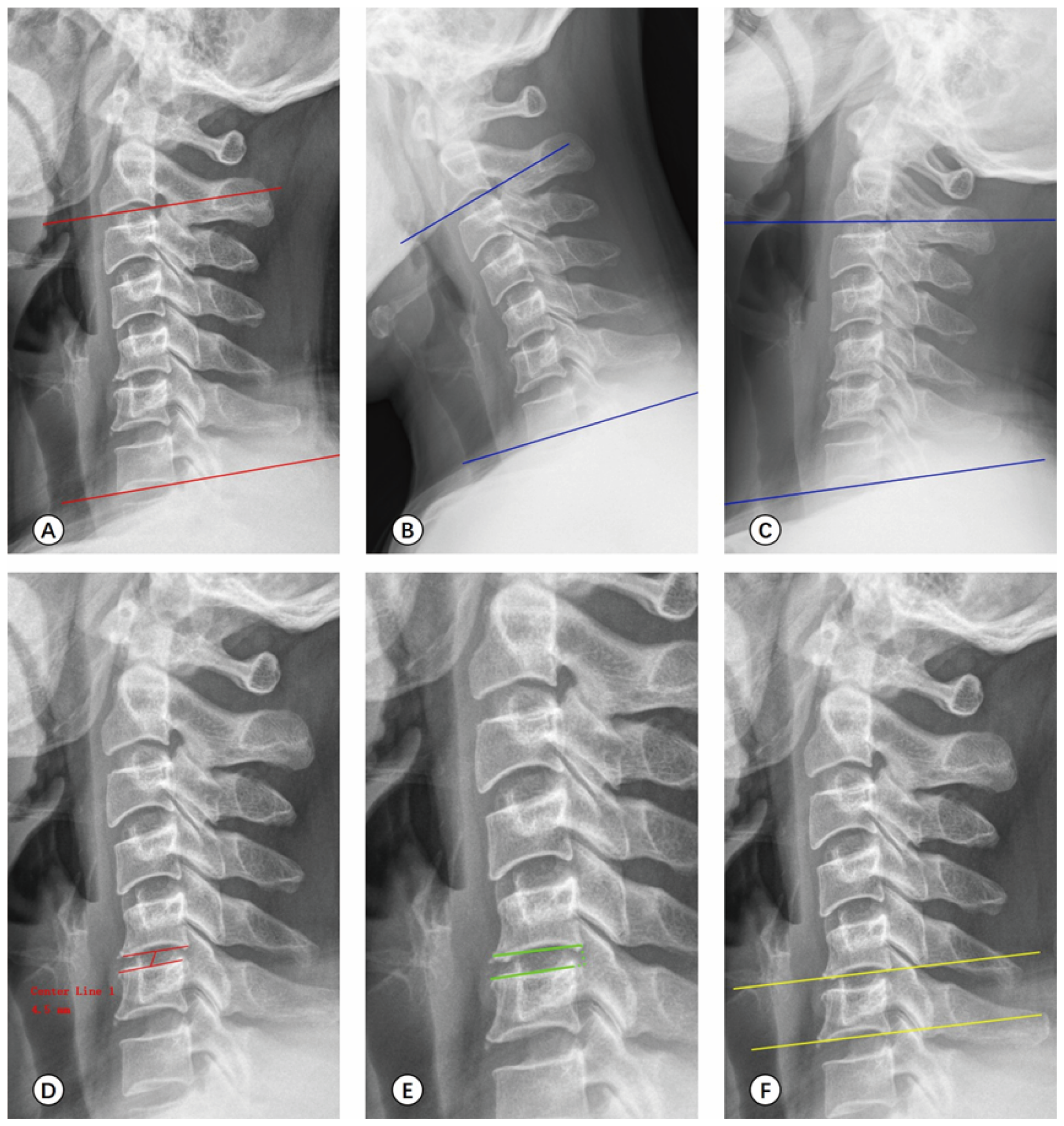 Medicina 59 00437 g006
