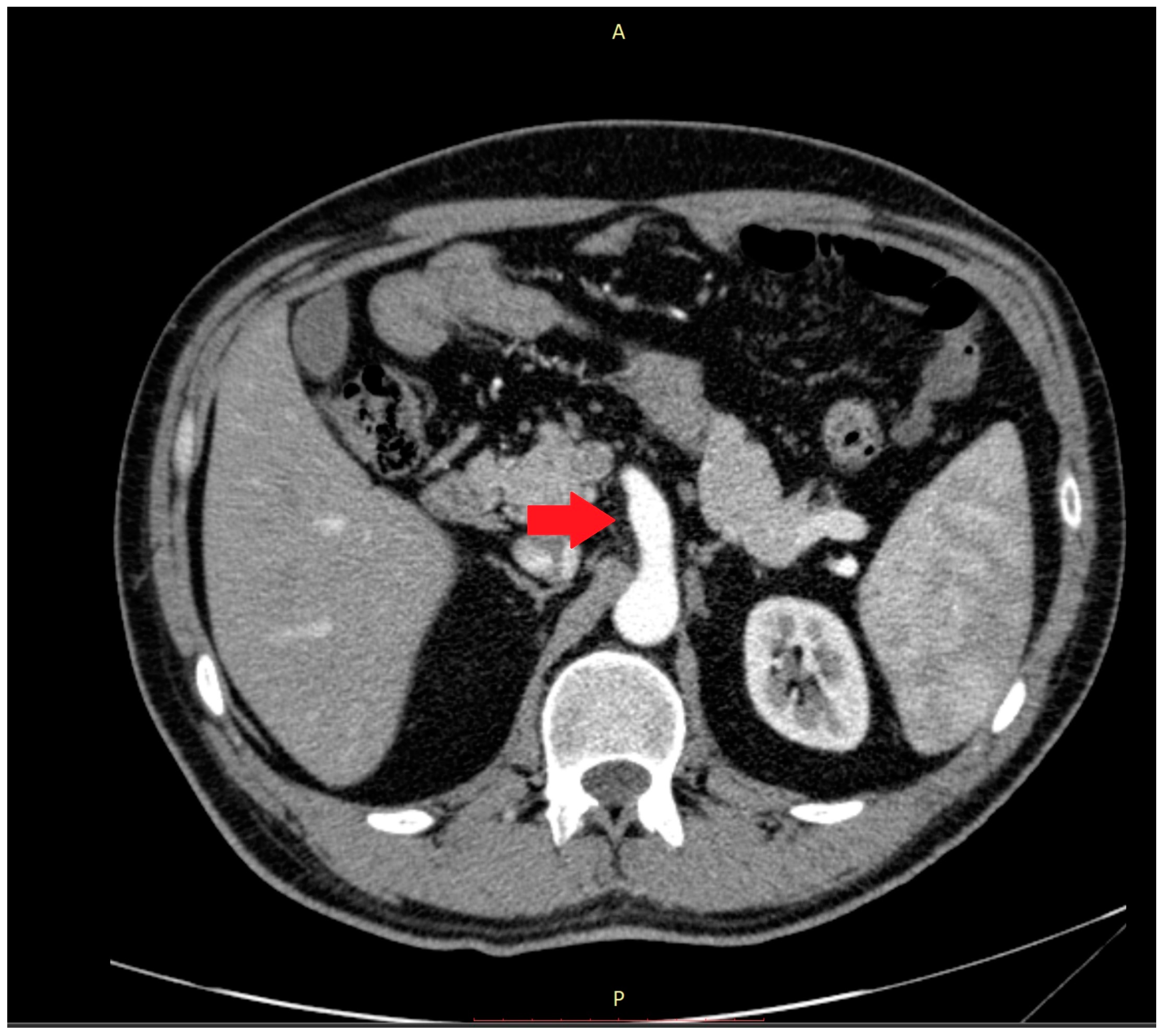 Medicina 59 00442 g002
