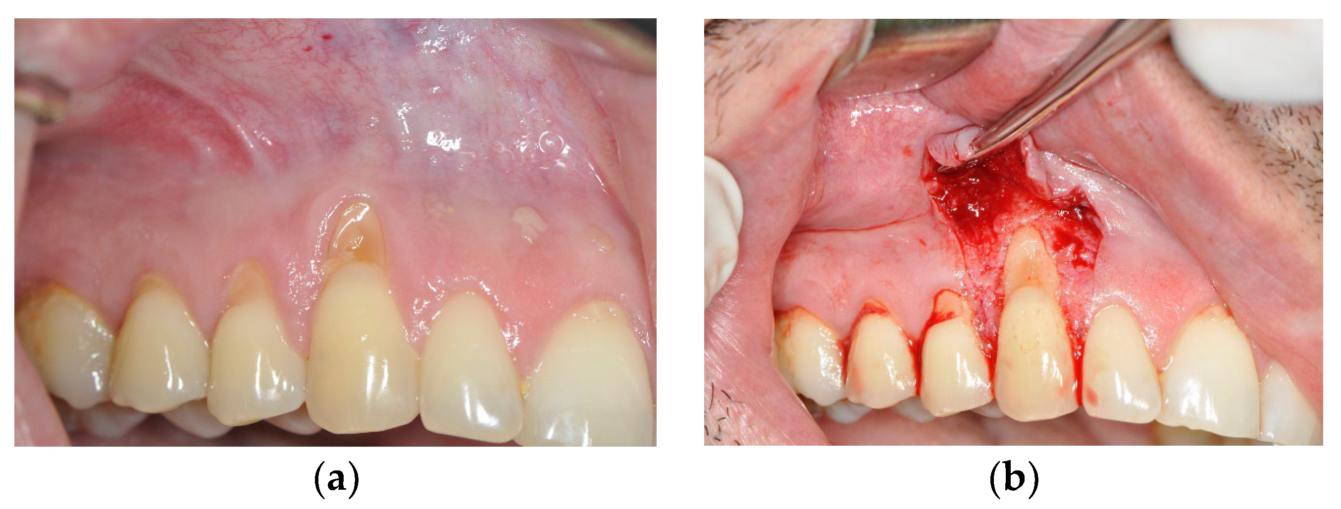 Medicina 59 00447 g001a Medicina 59 00447 g001a