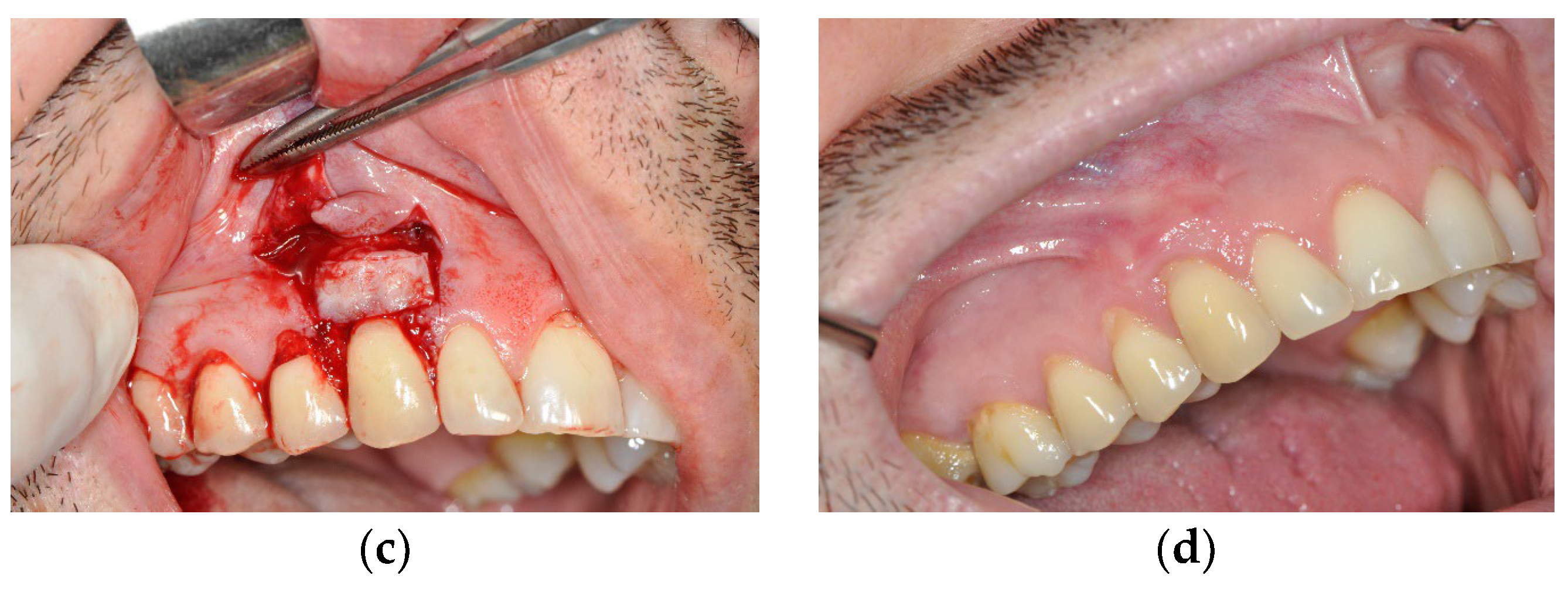 Medicina 59 00447 g001b Medicina 59 00447 g001b