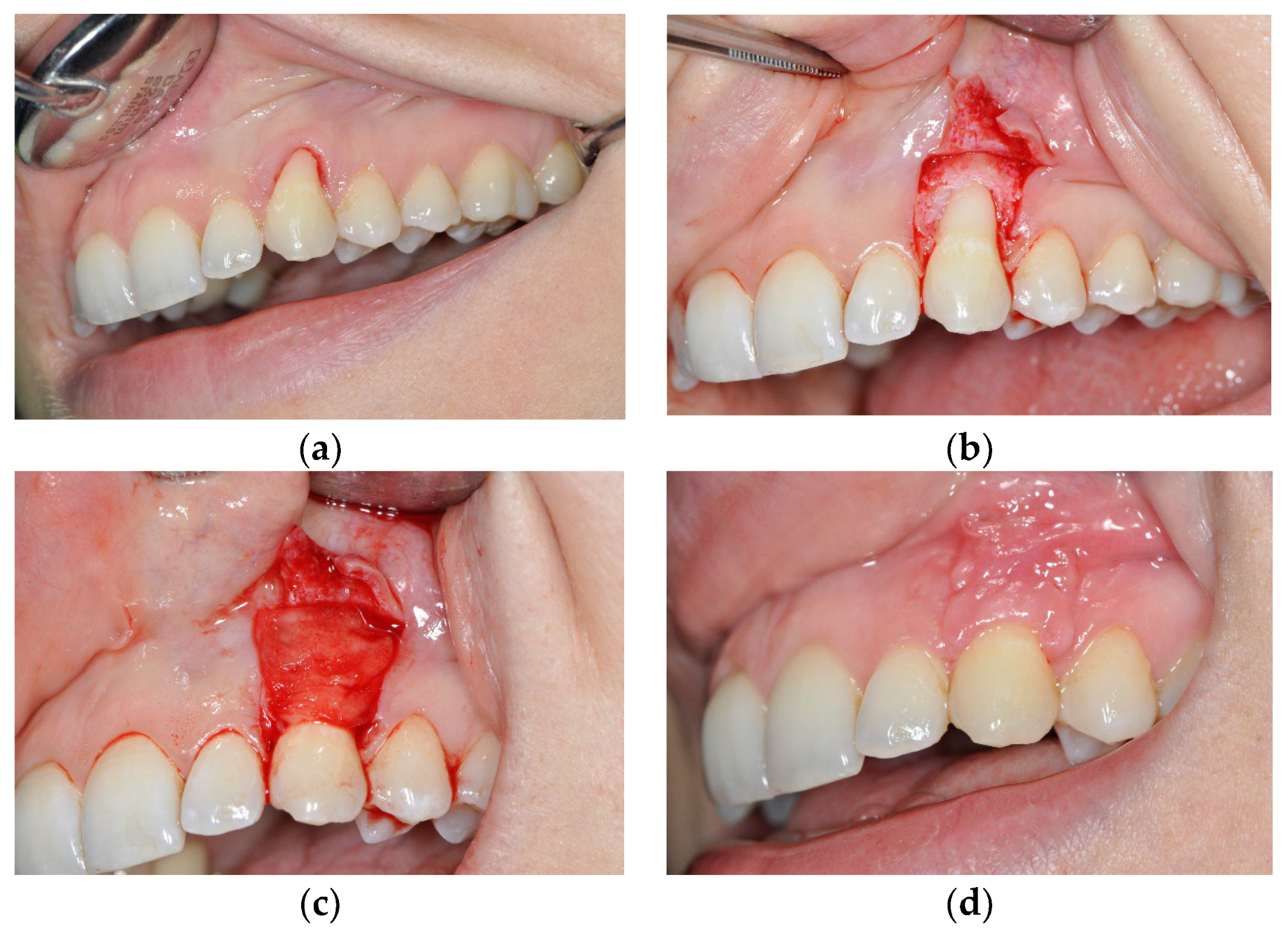 Medicina 59 00447 g002 Medicina 59 00447 g002