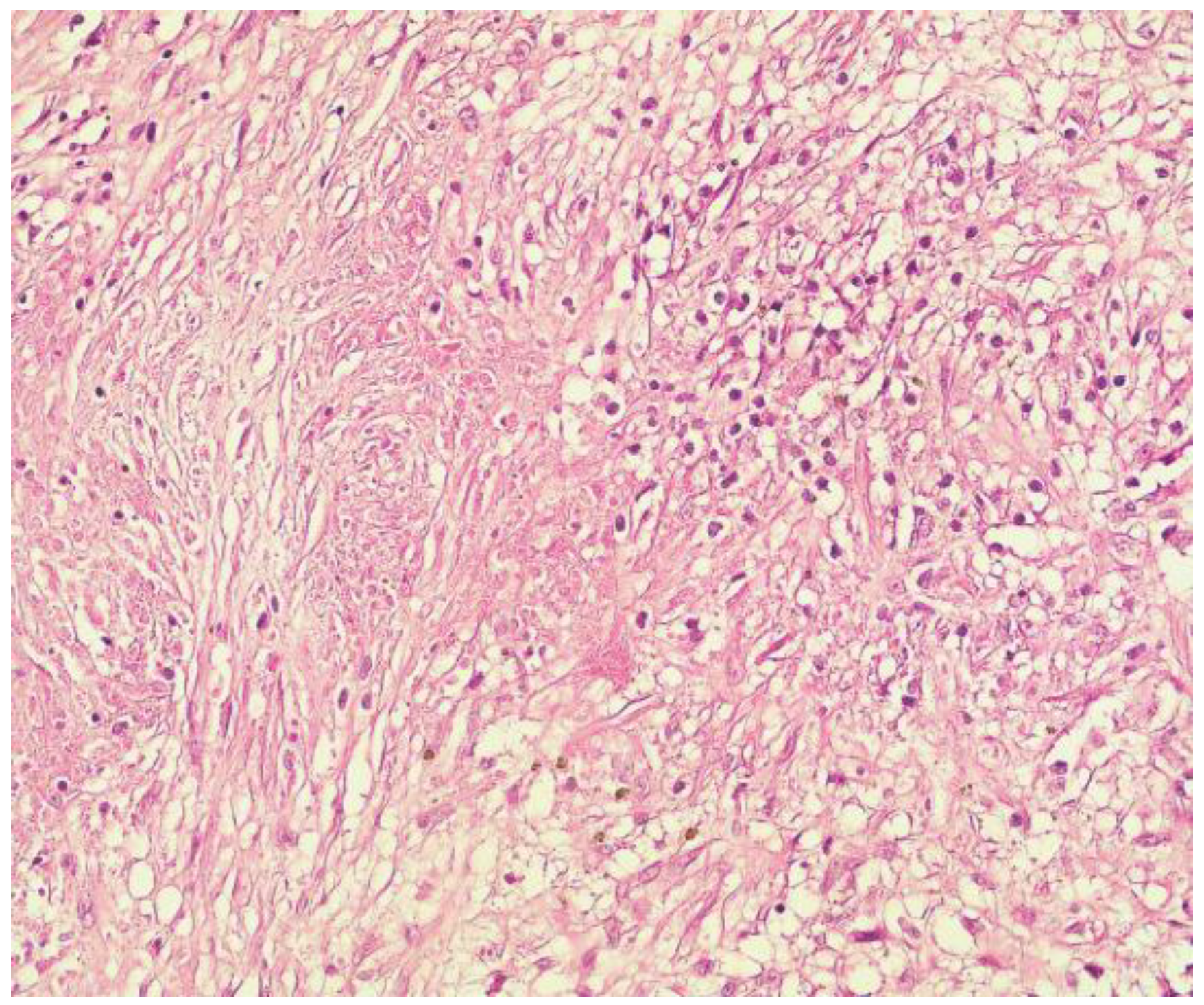 Medicina 59 00448 g003 Medicina 59 00448 g003