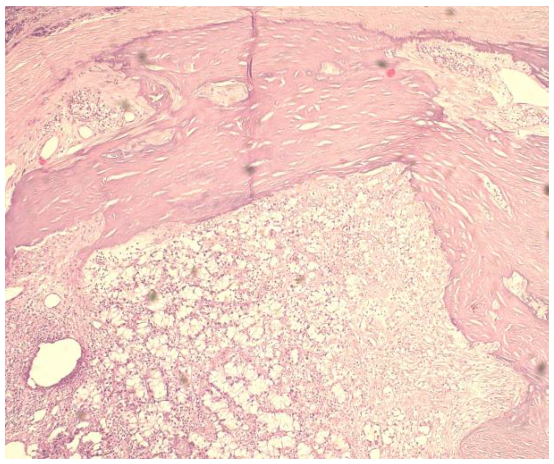 Medicina 59 00448 g004 Medicina 59 00448 g004