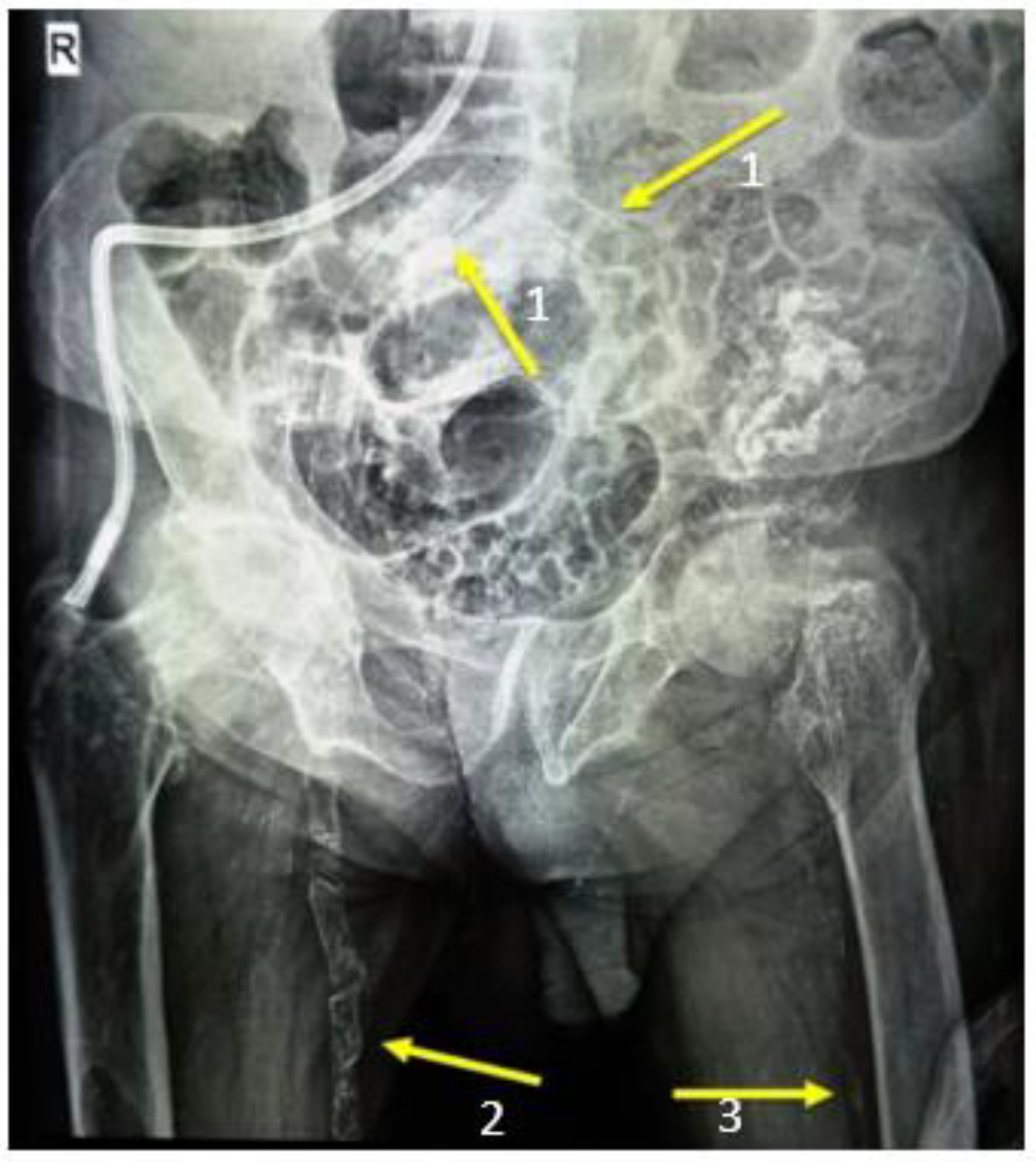 Medicina 59 00448 g005 Medicina 59 00448 g005