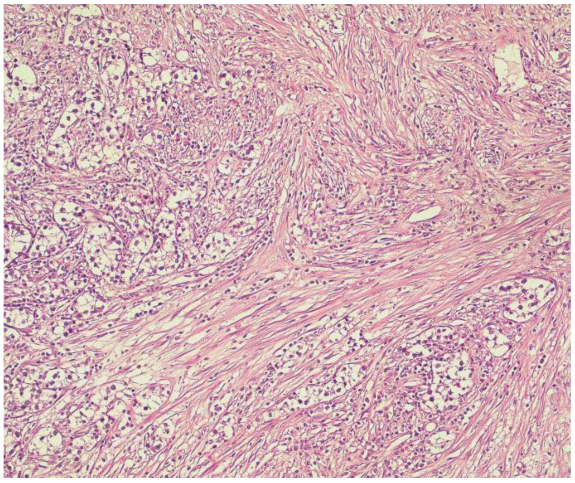 Medicina 59 00448 g006 Medicina 59 00448 g006