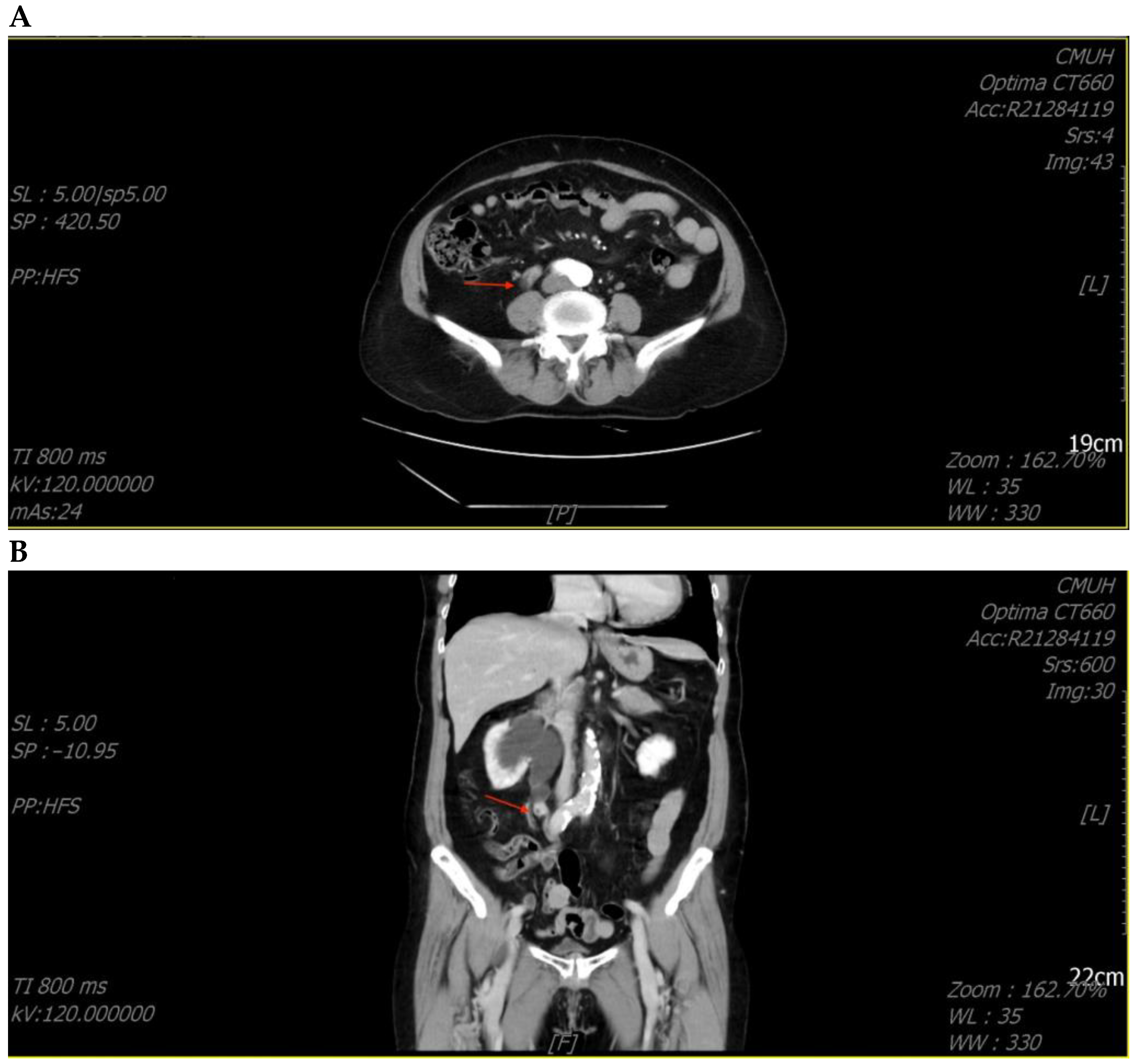 Medicina 59 00454 g003