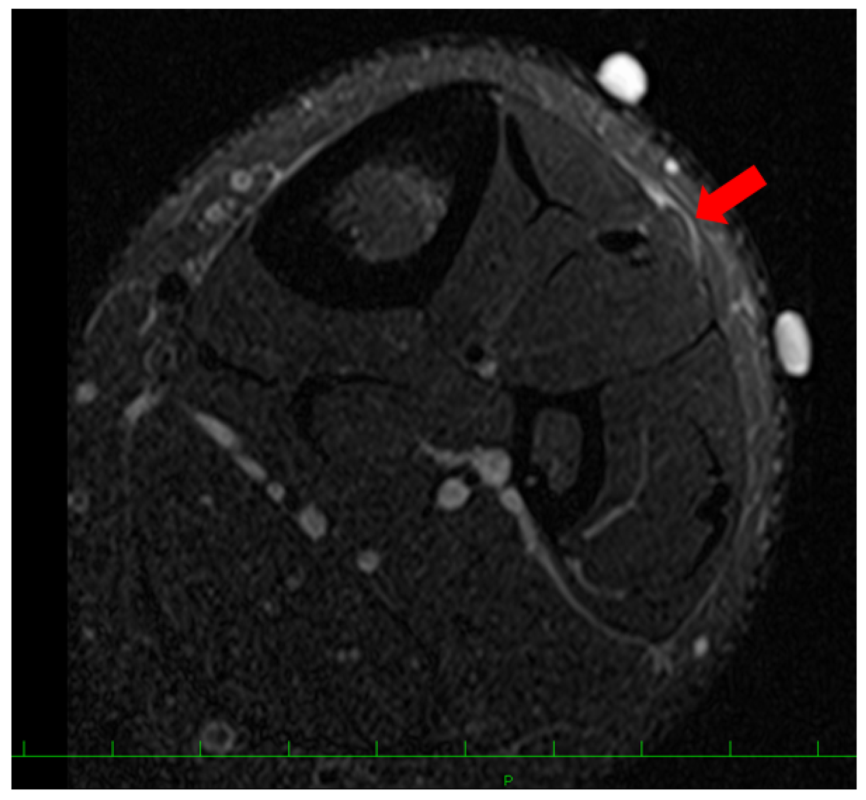 Medicina 59 00466 g003 Medicina 59 00466 g003