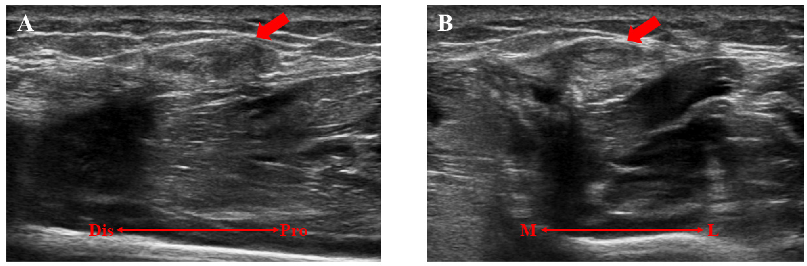 Medicina 59 00466 g005 Medicina 59 00466 g005