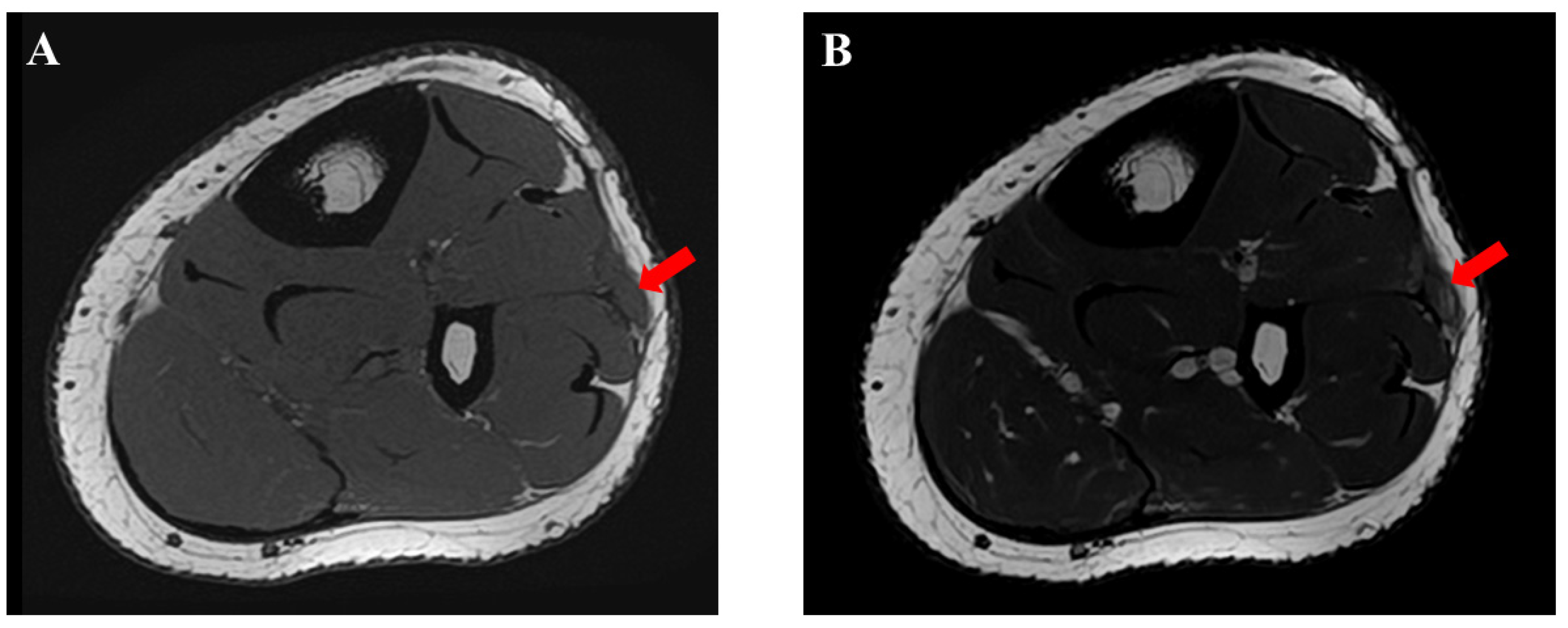 Medicina 59 00466 g006 Medicina 59 00466 g006