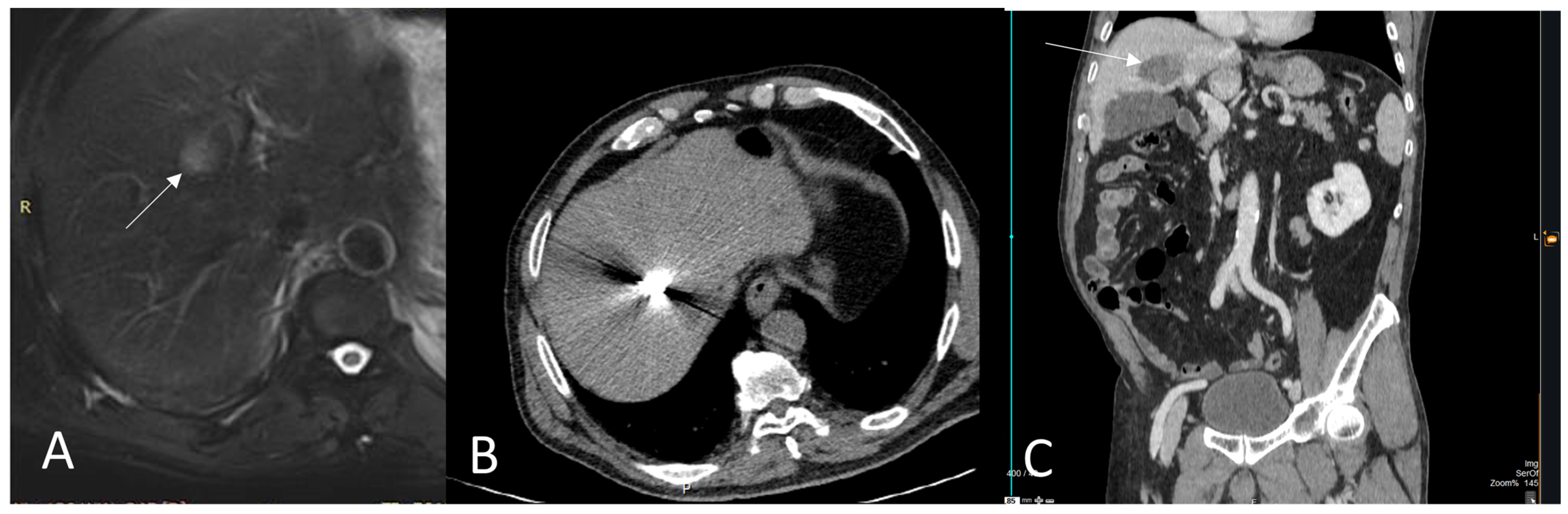 Medicina 59 00485 g002 Medicina 59 00485 g002