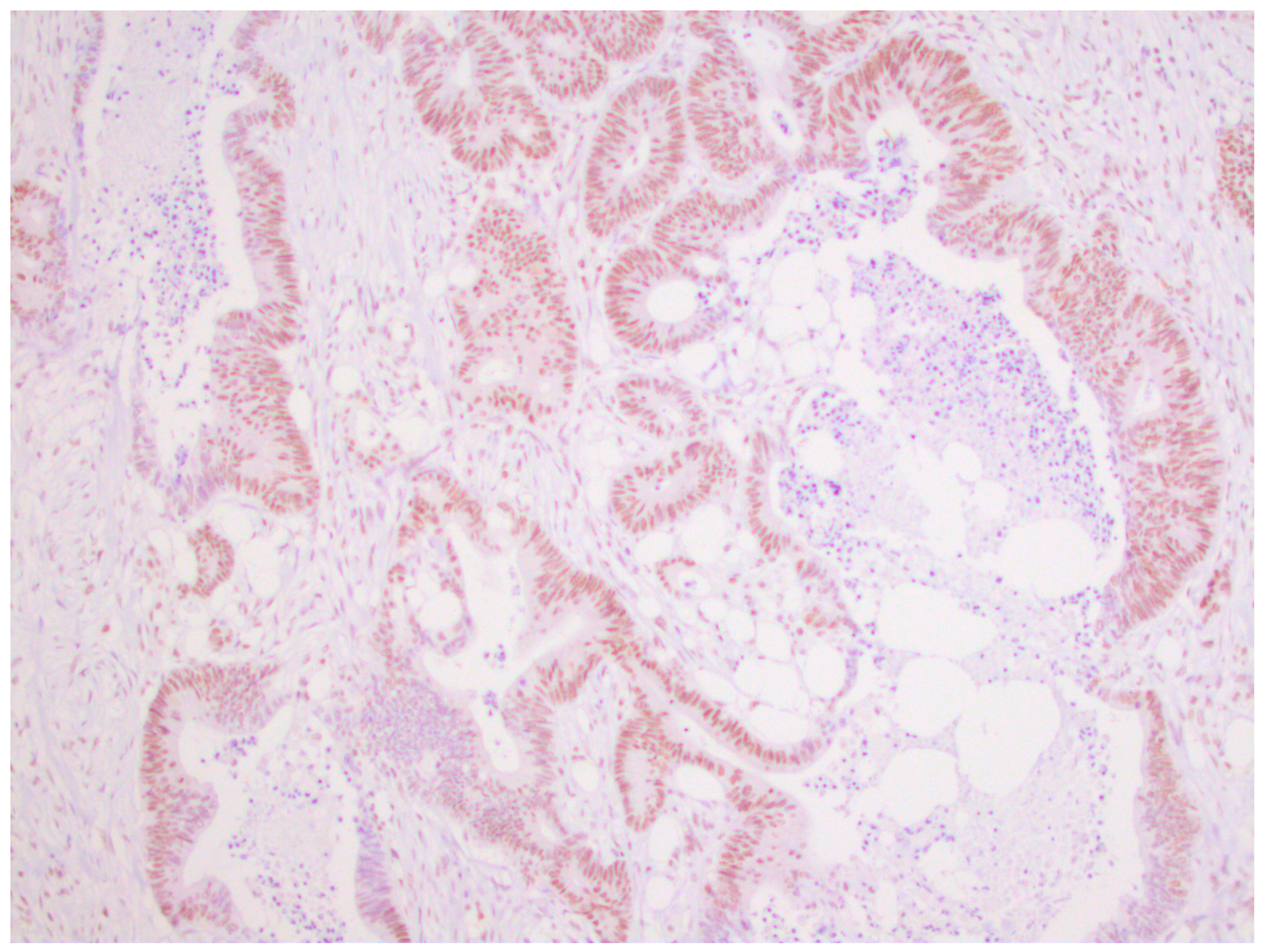 Medicina 59 00489 g002 Medicina 59 00489 g002