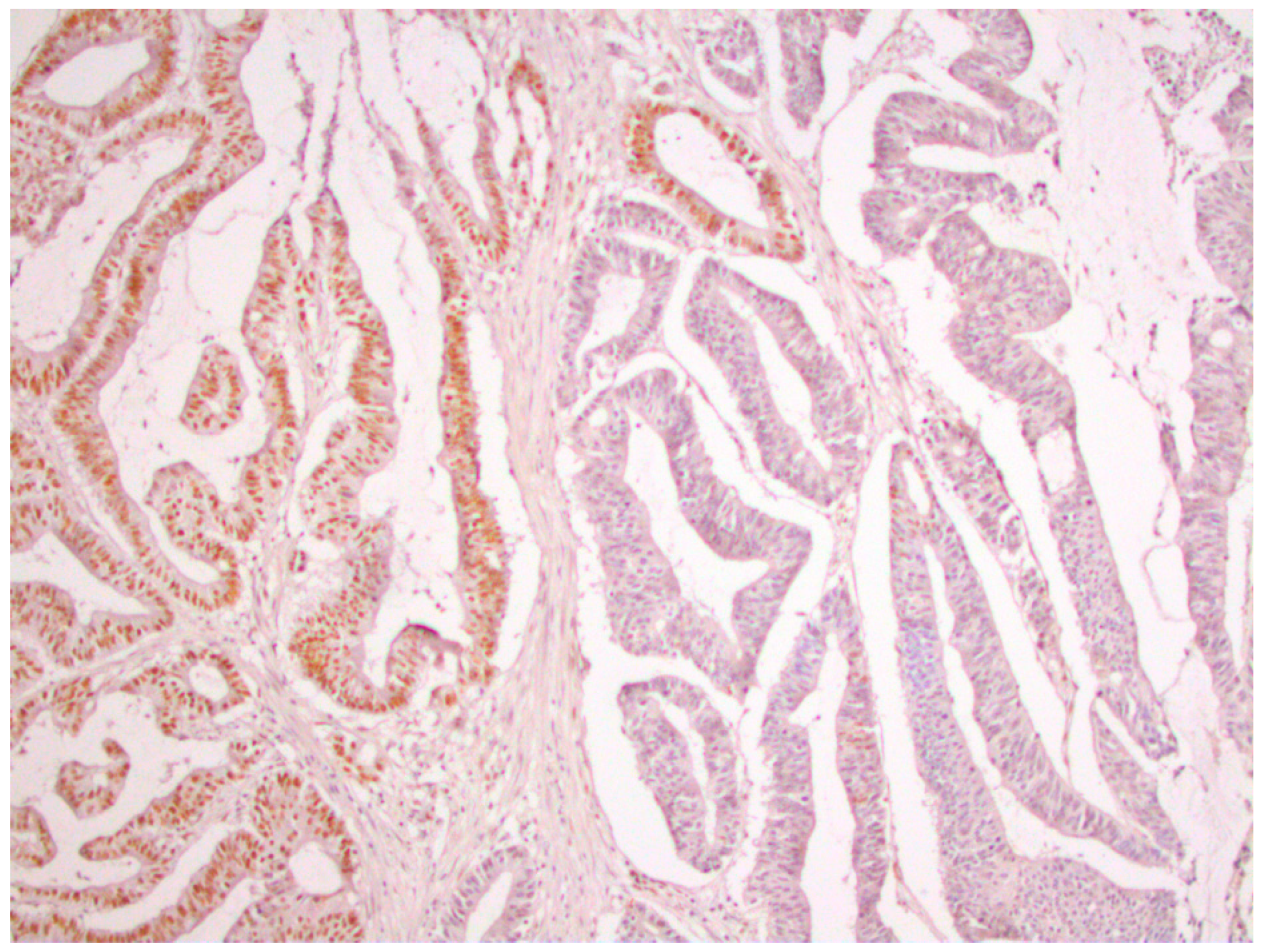 Medicina 59 00489 g003 Medicina 59 00489 g003