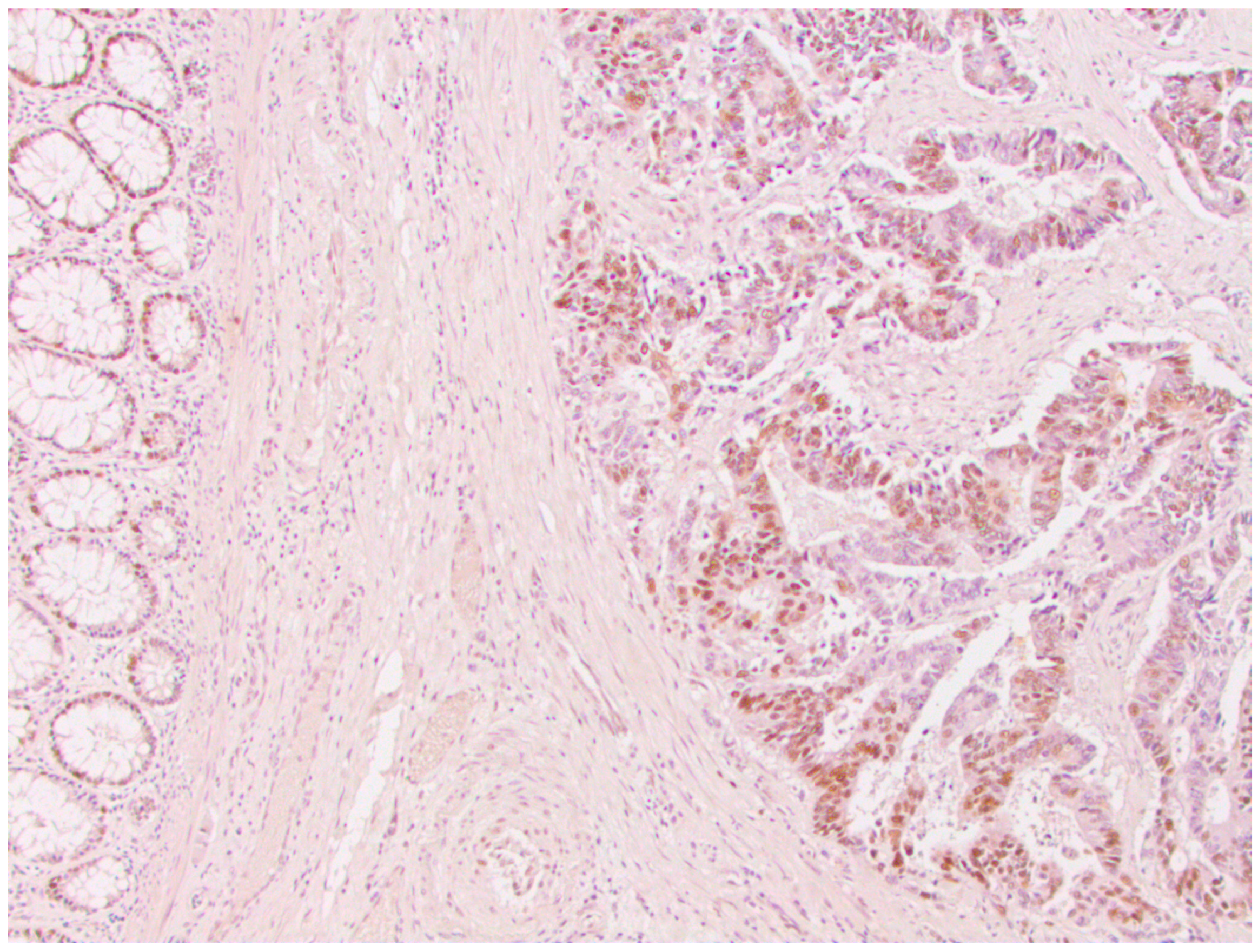 Medicina 59 00489 g004 Medicina 59 00489 g004