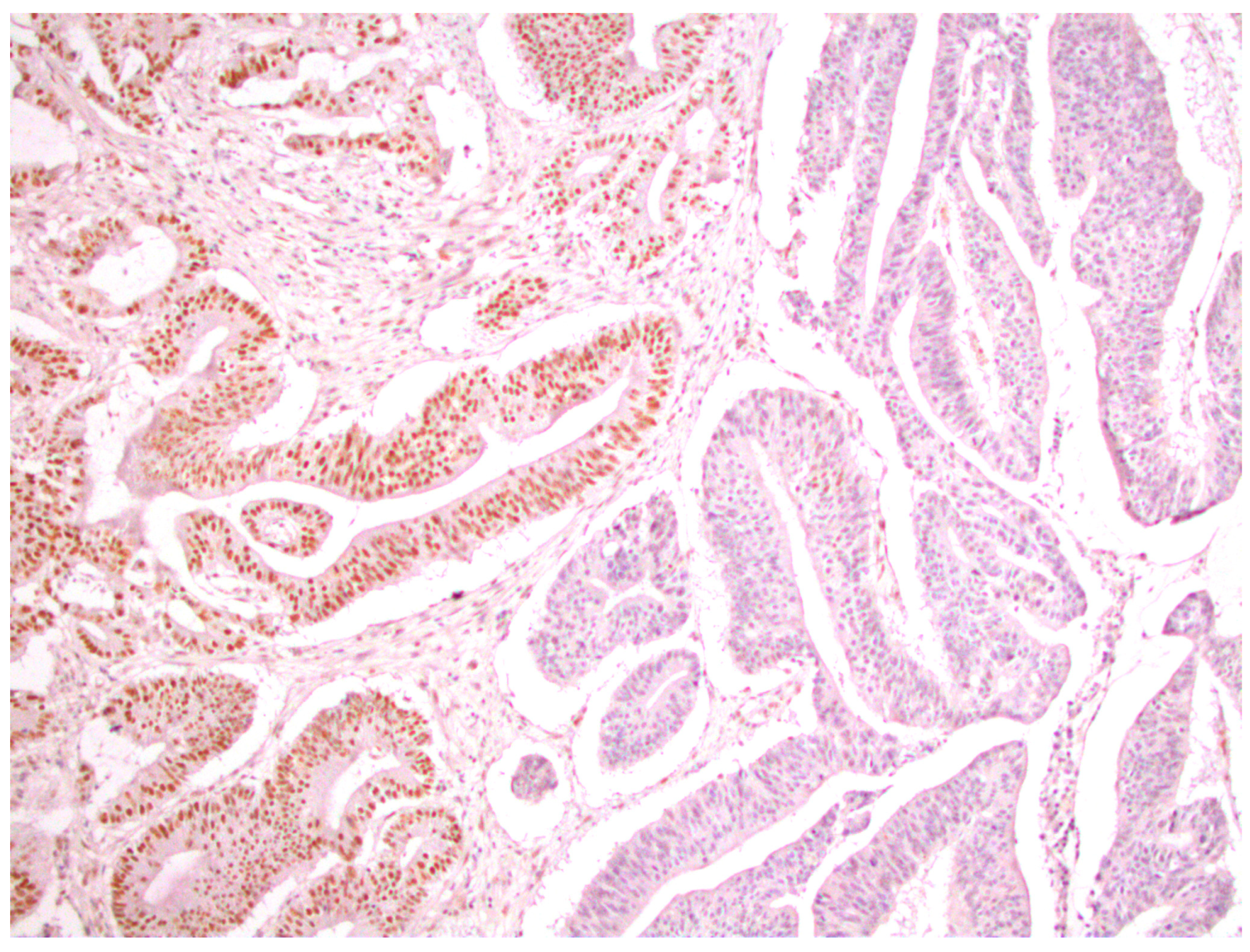 Medicina 59 00489 g005 Medicina 59 00489 g005