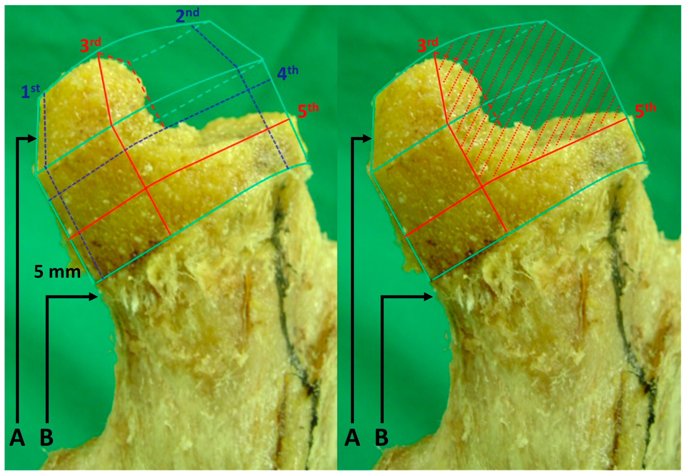 Medicina 59 00508 g002 Medicina 59 00508 g002