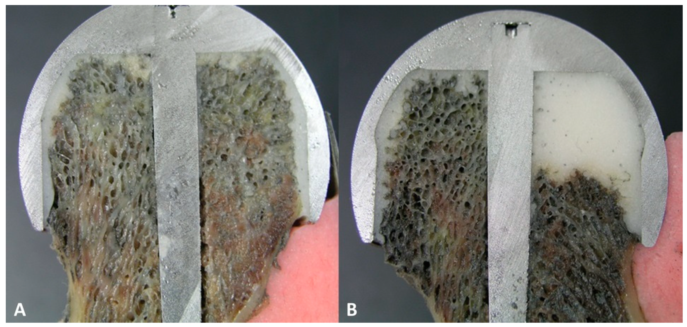 Medicina 59 00508 g004 Medicina 59 00508 g004