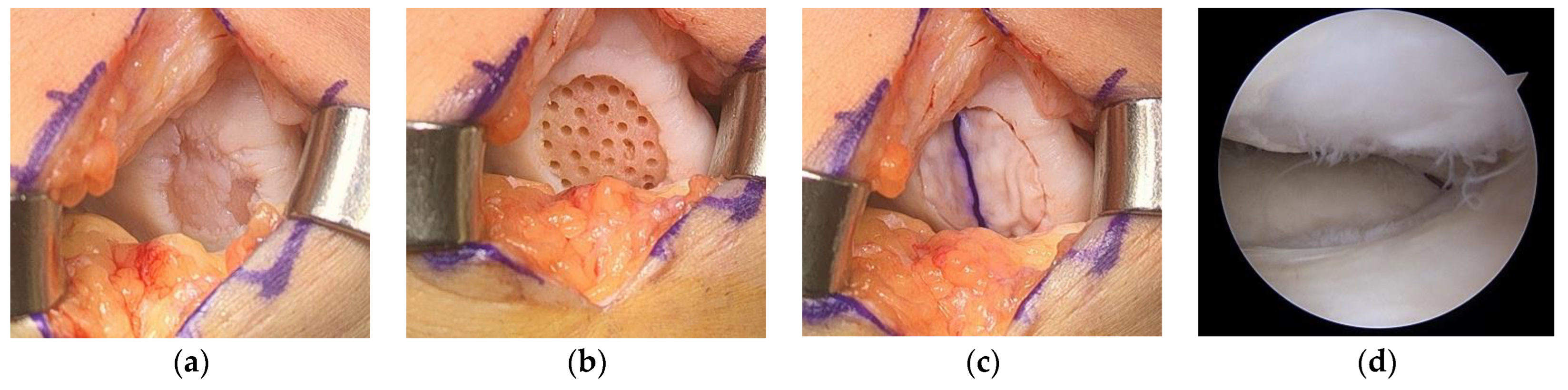 Medicina 59 00530 g005