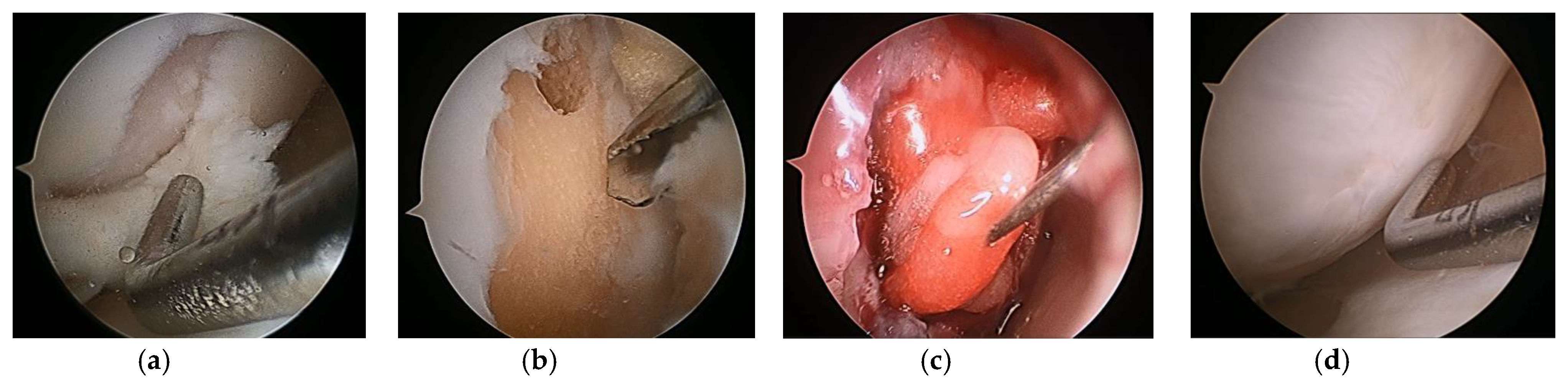 Medicina 59 00530 g010
