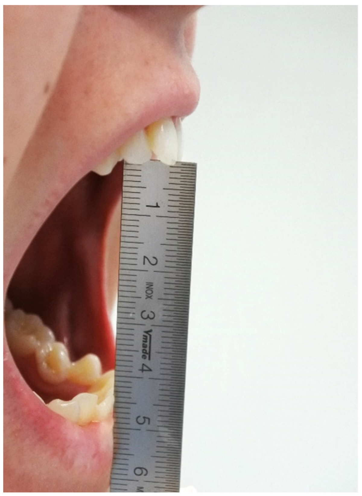 Medicina 59 00534 g002 Medicina 59 00534 g002