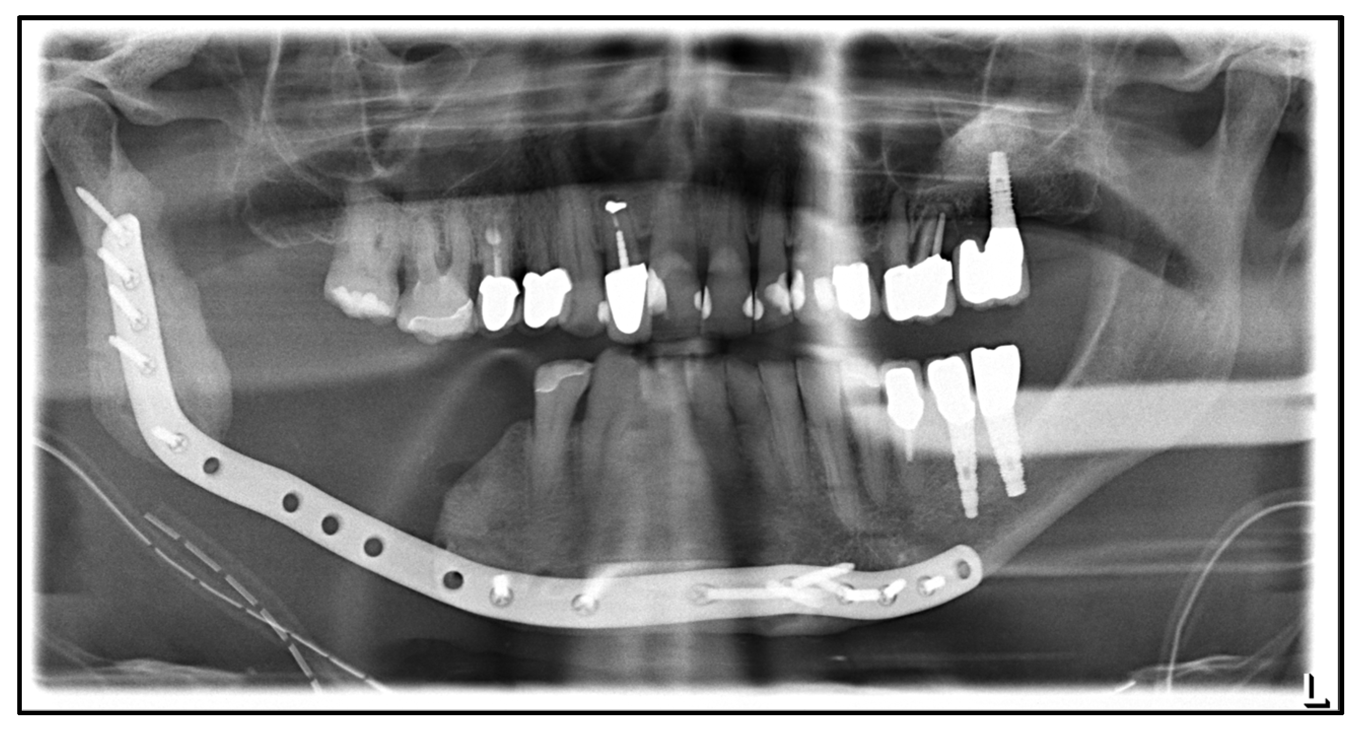 Medicina 59 00535 g002