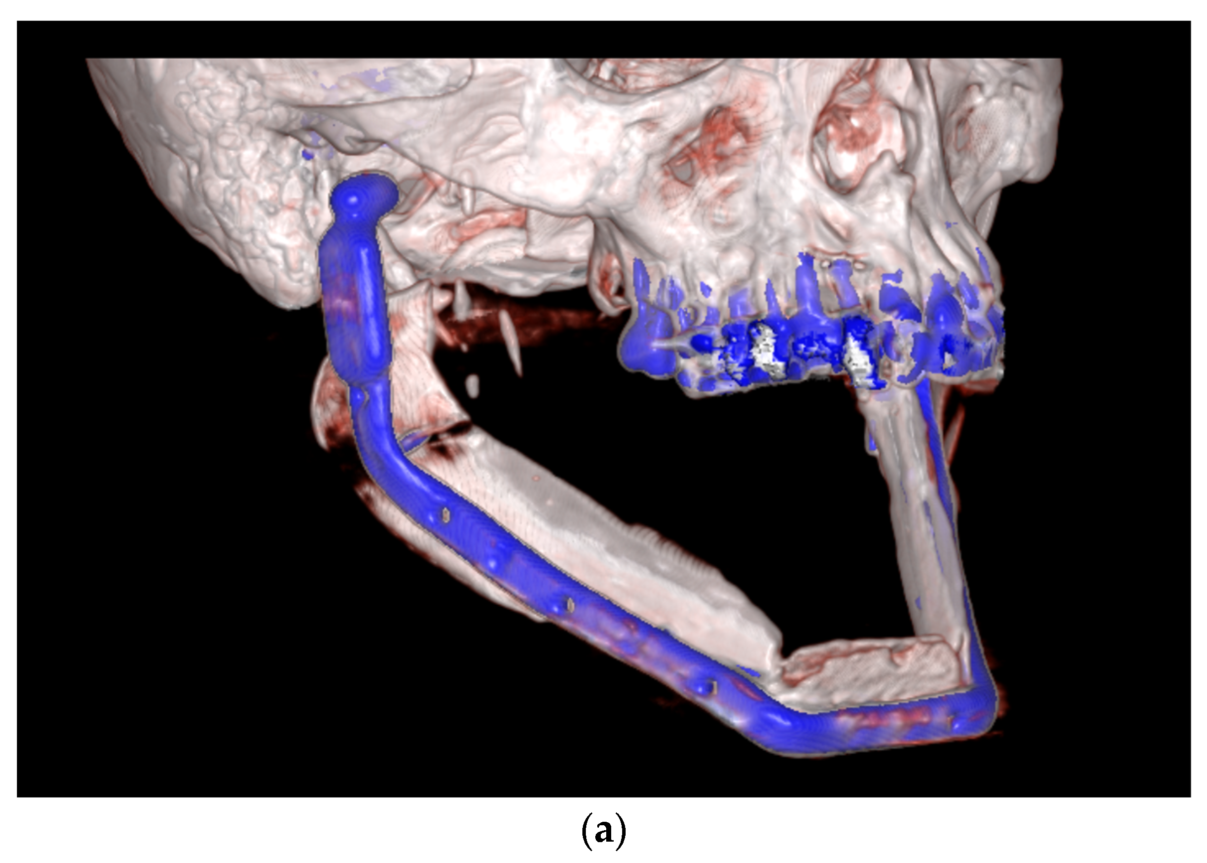 Medicina 59 00535 g004a