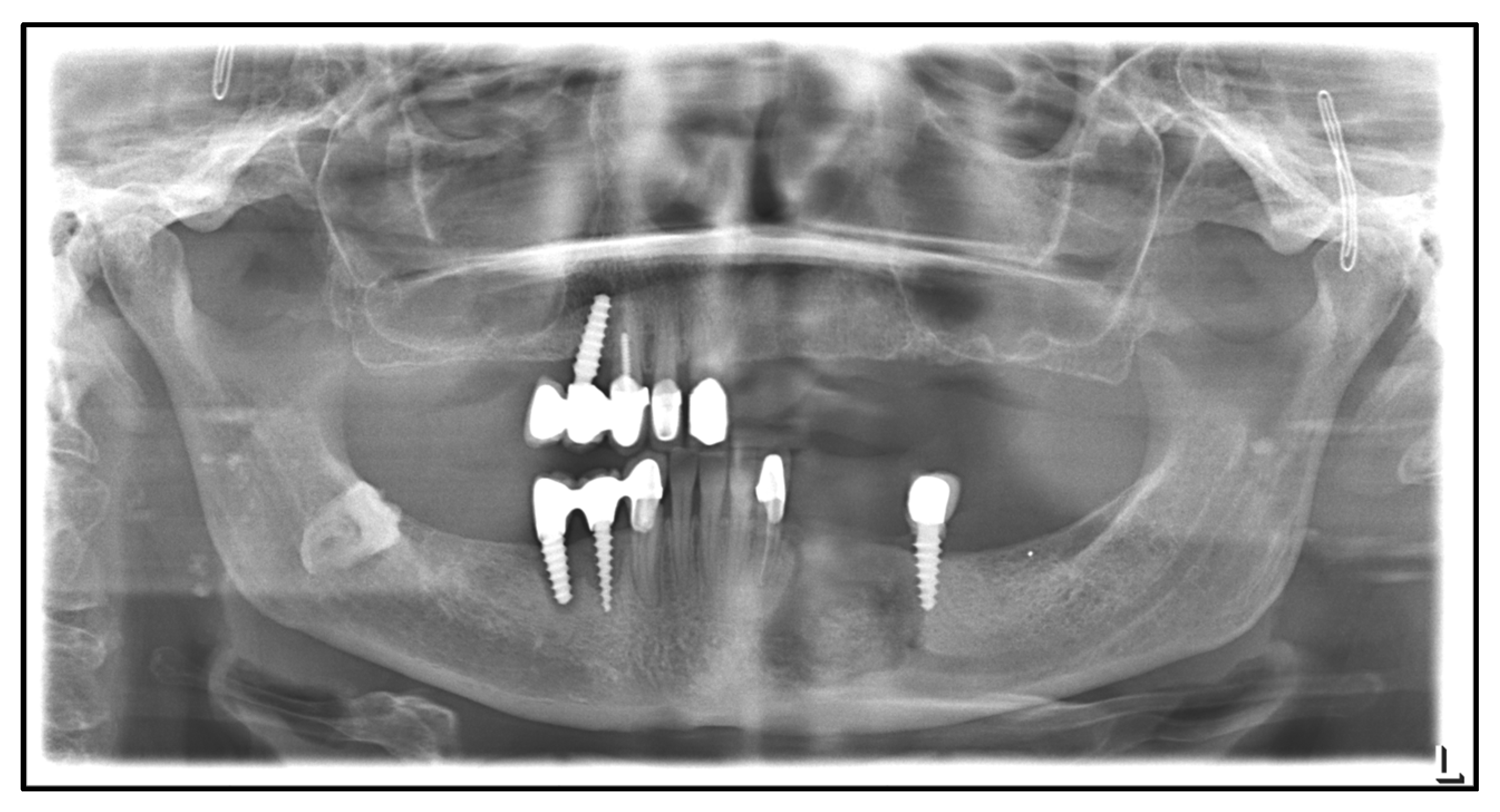 Medicina 59 00535 g005