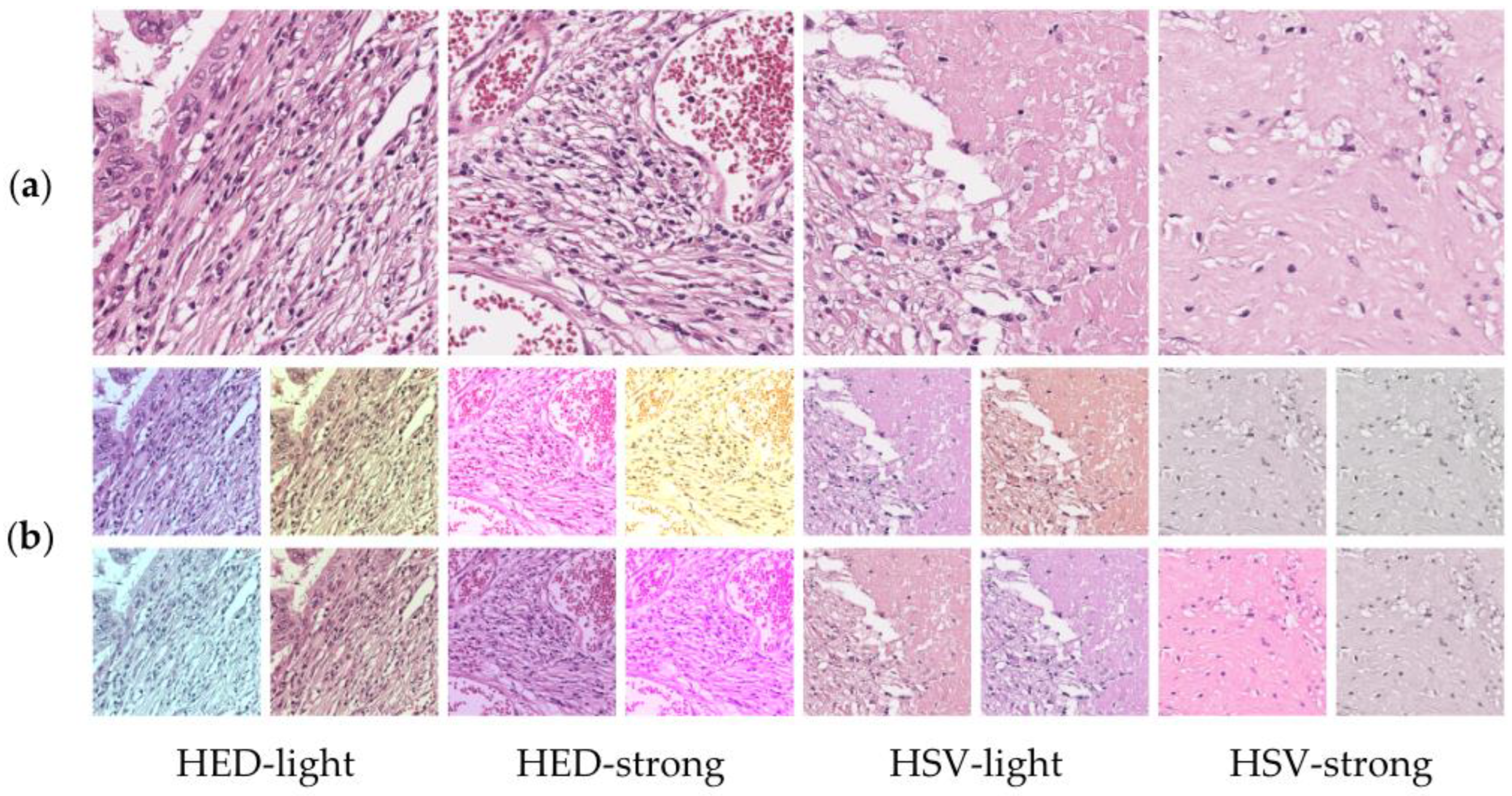 Medicina 59 00536 g004 Medicina 59 00536 g004
