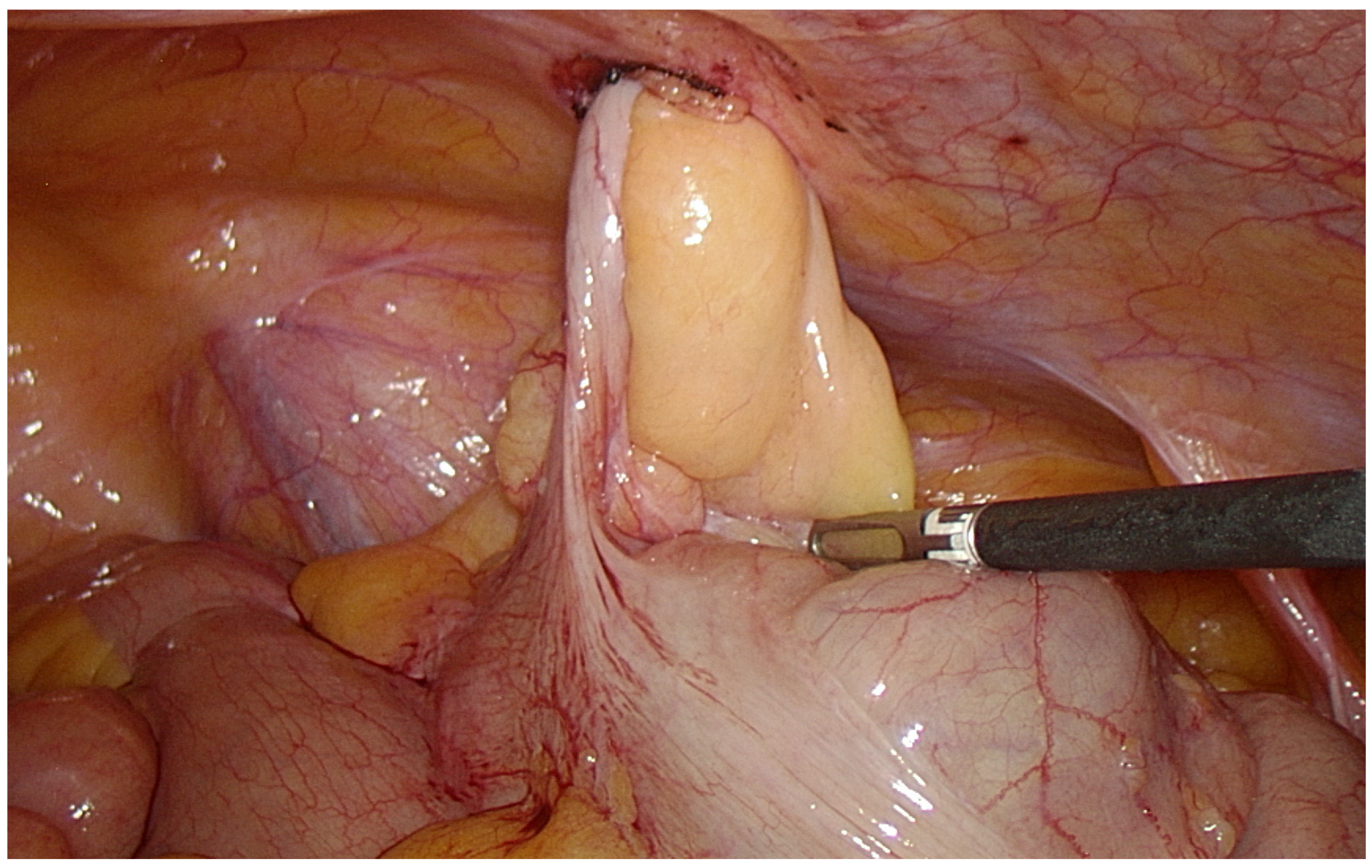 Medicina 59 00538 g002