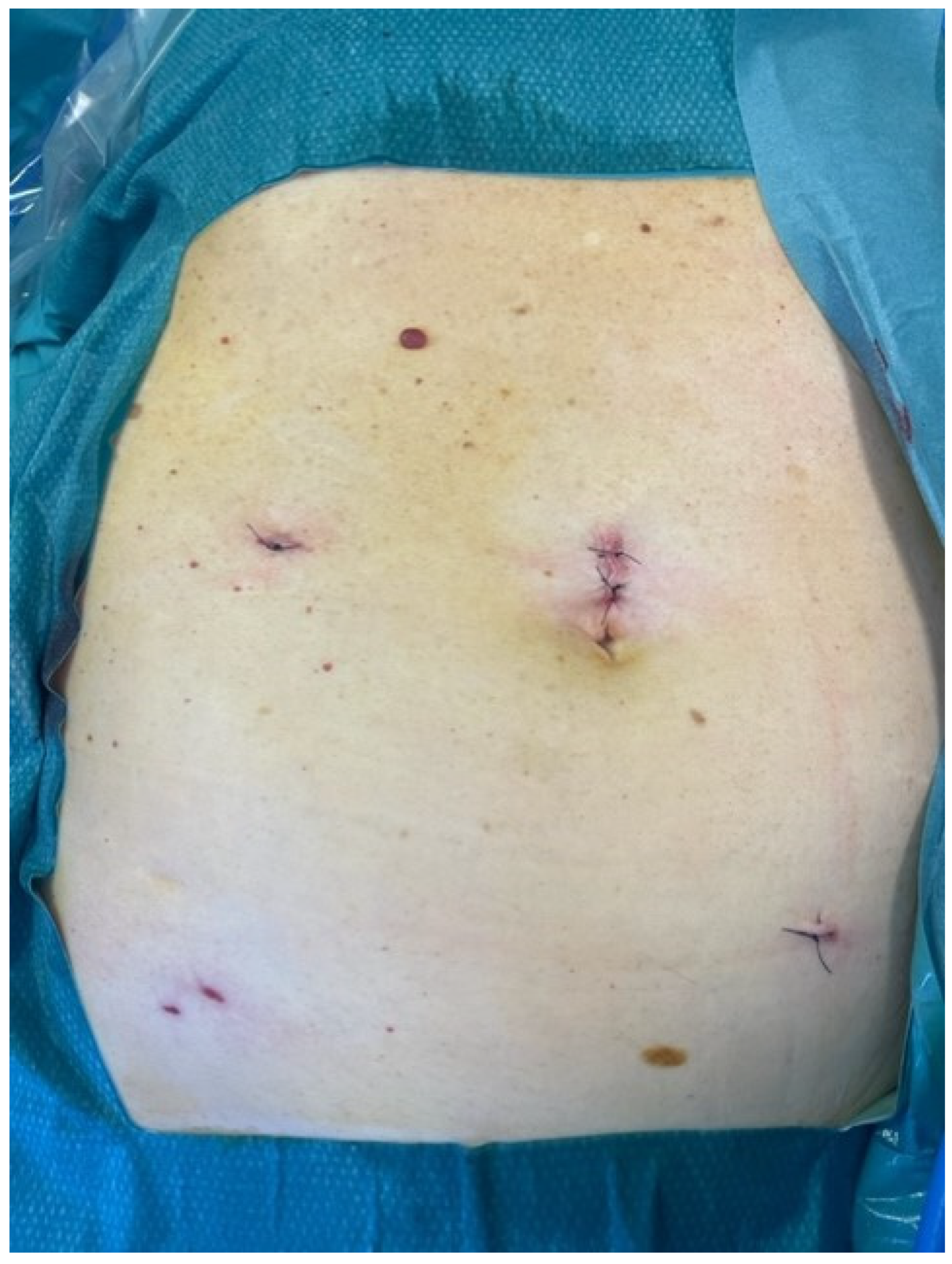 Medicina 59 00538 g003